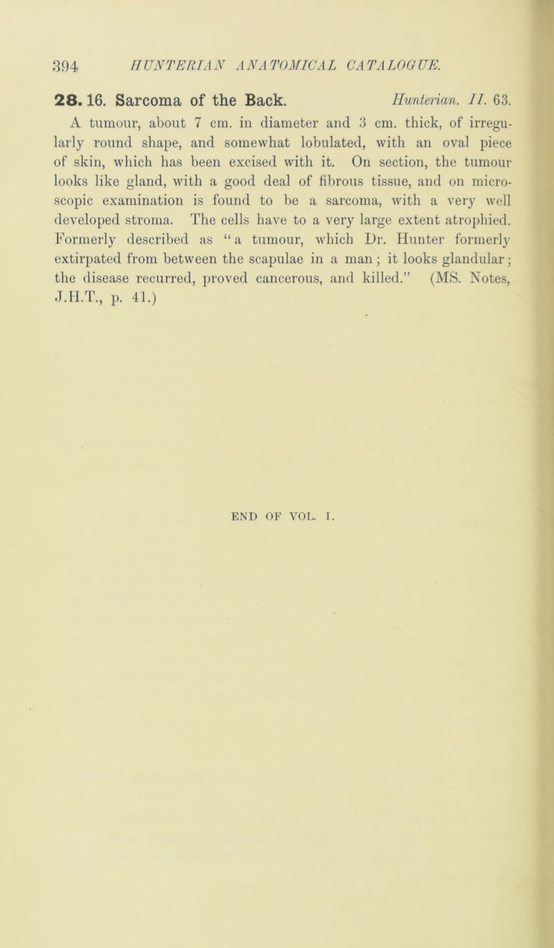 28.16. Sarcoma of the Back. Hunterian. II. 63. A tumour, about 7 cm. in diameter and 3 cm. thick, of irregu- larly round shape, and somewhat lobulated, with an oval piece of skin, which has been excised with it. On section, the tumour looks like gland, with a good deal of fibrous tissue, and on micro- scopic examination is found to be a sarcoma, with a very well developed stroma. The cells have to a very large extent atrophied. Formerly described as “ a tumour, which Dr. Hunter formerly extirpated from between the scapulae in a man; it looks glandular; the disease recurred, proved cancerous, and killed.” (MS. Notes, p. 41.) END OF VOL. I.