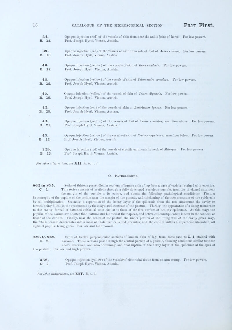 34. Opaque injection (red) of the vessels of tkin from near the ankle joint of horse. For low powers. B. 15. Prof. Joseph Hyrtl, Vienna, Austria. 39. Opaque injection (red) ot the vessels of skin from sole of foot of Ardca cincrca. For low powers B. 16. Prof. Joseph Hyrtl, Vienna, Austria. 4©. Opaque injection (yellow) of tho vessels of skin of Rana csculcnta. For low powers. B. 17. Prof. Joseph Hyrtl, Vienna, Austria. 41. Opaque injection (yellow) of the vessels of skin of Salamandra maculosa. For low powers. B. 18. Prof. Joseph Hyrtl, Vienna, Austria 42. Opaque injection (yellow) of the vessels of skin of Triton Alpestris. For low powers. B. 19. Prof. Joseph Hyrtl, Vienna, Austria. 43. Opaque injection (red) of the vessels of skin ot Bombinator igncus. For low powers. B. 20. Prof. Joseph Hyrtl, Vienna, Austria. 44. Opaque injection (yellow) of the vessels of foot of Triton cristatus; seen from above. For low powers. B. 21. Prof. Joseph Hyrtl, Vienna, Austria.  45. Opaque injoction (yellow) of the vessels of skin of Proteus anguineus; seen from below. For low powers. B. 22. Prof. Joseph Hyrtl, Vienna, Austria. 339. Opaque injection (red) of the vessels of erectile caruneula in neck of Meleager. For low powers. B. 23. Prof. Joseph Hyrtl, Vienna, Austria. For other illustrations, see XII. A. l(. I, 2. C. Pathological. §63 to 875. Series of thirteen perpendicular sections of human skin of leg from a case of variola; stained with carmine. C. 1. This series consists of sections through a fully-developed variolous pustule, from the thickened skin near the margin of the pustule to its centre, and shows the following pathological conditions: First, a hypertrophy of the papillae ot the eoriura near the margin of the pustule, and thickening of the rete mucosum of the epidermis by cell-multiplication. Secondly, a separation of the horny layer of the epidermis from the rete mucosum; the cavity so formed being filled (in the specimens) by the coagulated contents of the pustule. Thirdly, the appearance of a lining membrane to this cavity, formed of flattened epithelial cells similar to those of the free surface of healthy epidermis. At this stage the papilla; of the corium are shorter than natural aud blunted at their apices, and active cell-multiplication is seen in the connective tissue of the corium. Finally, near Ihe centre of the pustule the under portion of the lining wall of the cavity gives way, the rete mucosum degenerates into a mass of ill-defined cells and granules, and the corium suffers a superficial ulceration, all signs of papilla; being gone. For low and high powers. 876 to 887. Series of twelve perpendicular sections of human skin of leg, from same case as C. 1, stained with C. 2. carmine. These sections pass through the central portion of a pustule, showing conditions similar to those above described, aud also a thinning aud final rupture of the horny layer of the epidermis at the apex of the pustule. For low and high powers. 358. Opaque injection (yellow) of tho vesselsn>f cicatricial tissue from an arm stump. For low powers. C. 3. Prof. Joseph Hyrtl, Vienna, Austria.