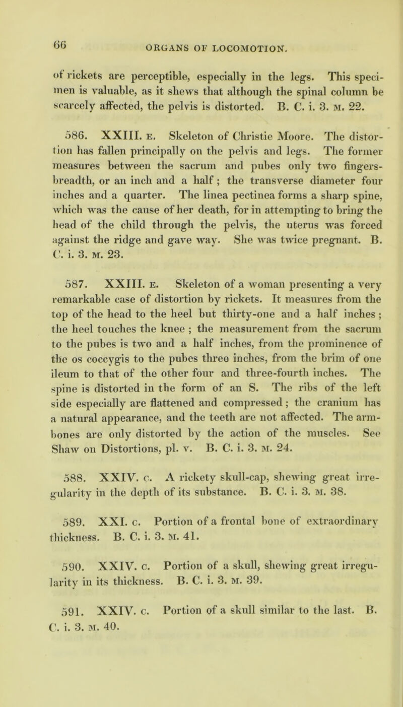 ot rickets are perceptible, especially in tlie legs. This speci- men is valuable, as it shews that although the spinal column be scarcely affected, the pelvis is distorted. B. C. i. 3. m. 22. .586. XXIII. E. Skeleton of Christie Moore. The distor- tion has fallen principally on the pelvis and legs. The former measures between the sacrum and jnibes only two fingers- breadth, or an inch and a half; the transverse diameter four inches and a quarter. The linea pectinea forms a sharp spine, which was the cause of her death, for in attempting to bring the head of the child through the pelvis, the uterus was forced against the ridge and gave way. She was twice pregnant. B. ('. i. 3. M. 23. 387. XXIII. E. Skeleton of a woman presenting a very remarkable case of distortion by rickets. It measures from the top of the head to the heel but thirty-one and a half inches ; the heel touches the knee ; the measurement from the sacrum to the pubes is two and a half inches, from the prominence of the os coccygis to the pubes three inches, from the brim of one ileum to that of the other four and three-fourth inches. The spine is distorted in the form of an S. The ribs of the left side especially are flattened and compressed; the cranium has a natural appearance, and the teeth are not affected. The arm- bones are only distorted by the action of the muscles. See Shaw on Distortions, pi. v. B. C. i. 3. m. 24. 588. XXIV. c. A rickety skull-cap, shewing great irre- gularity in the depth of its substance. B. C. i. 3. m. 38. 589. XXL c. Portion of a frontal bone of extraordinary thickness. B. C. i. 3. >r. 41. 390. XXIV. c. Portion of a skull, shewing great irregu- larity in its thickness. B. C. i. 3. m. 39. 591. XXIV. c. Portion of a skull similar to the last. B. (’. i. 3. M. 40.