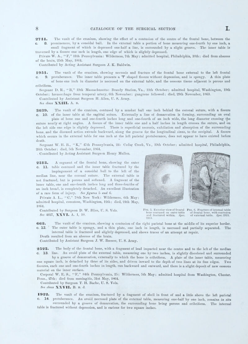 2744. The vault of tlie cranium, showing the effect of a contusion of the centre of the frontal bone, between the c. 8. prominences, by a conoidal ball. In the external table a portion of bone measuring one-fourth by one inch, a small fragment of which is depressed one-half a line, is surrounded by a slight groove. The inner table is traversed by a fissure one inch in length, one edge of which is slightly depressed. Private W. A., F, 11th Pennsylvania: Wilderness, 7th May; admitted hospital, Philadelphia, 18th; died from abscess of the brain, 25th May, 18G4. Contributed by Acting Assistant Surgeon J. K. Baldwin. 1951. The vault of the cranium, showing necrosis and fracture of the frontal bone external to the left frontal c. 9. protuberance. The inner table presents a T shaped fissure without depression, and is spongy. A thin plate of bone one inch in diameter is necrosed on the external table, and the osseous tissue adjacent is porous and cribriform. Sergeant D. R., B, 19th Massachusetts: Brandy Station, Va., 11th October; admitted hospital, Washington, 19th October; haemorrhage from temporal artery, 6th November; gangrene followed; died, 29th November, 1863. Contributed by Assistant Surgeon H. Allen, U. S. Army. See class XXIII. A. B. 3039. The vault of the cranium, contused by a musket ball one inch behind the coronal suture, with a fissure c. 10. of the inner table at the sagittal suture. Externally a line of demarcation is forming, surrounding an oval plate of bone one and one-fourth inches long and one-fourth of an inch wide, the long diameter crossing the suture nearly at right angles. A fissure of the inner table one and a half inches in length crosses the suture, and on the left side one edge is slightly depressed. There is superficial necrosis, exfoliation and absorption of the surrounding bone, and the diseased action extends backward, along the groove for the longitudinal sinus, to the occipital. A fissure which occurs in the external table for one inch at the left parietal protuberance, does not appear to have existed before death. Sergeant W. H. B., K, 47th Pennsylvania, 24: Cedar Creek, Va , 19th October; admitted hospital, Philadelphia, 2Gth October; died, 5th November, 18G4. • Contributed by Acting Assistant Surgeon Henry Mullen. ■ ■ ..: 2313. A segment of the frontal bone, showing the outer | ^. ■-X [ ^'^-^ / C. 11. table {•■•ntilM-d and the inner table I'ractulcd by llic jc-J.*' ,|faV' impingement of a conoidal ball to the left of the _ median line, near the coronal suture. The external table is '■ not fractured, but is porous and softened. A fragment of the I inner table, one and one-fourth inches long and three-fourths of jfe^ -S '. an inch broad, is completely detached. An excellent illustration B of a rare form of injury. Sec figures 5 and G. Private A. L.,  C, 78th New York: Wilderness, Gth May; £ admitted hospital, comatose, Washington, 12th : died, 21th .May, 1864. Contributed by Surgeon D. W. Bliss, U. S. Vols. FIG- Exterior view of frontal Fig. 6. Fracture of internal table _ ,„„_ . , bone contiiM'd on outer table ■•! frontal bone, with contusion See 462/, XXVI. A. 1, 10. :,„.l fractured within. Spec. of external table. Spec. 8313. 2313. 662. The vault of the cranium, showing a contusion of the right parietal bone at the middle of its superior border, c. 12. The outer table is spongy, and a thin plate, one inch in length, is necrosed and partially separated. The internal table is fractured and slightly depressed, and shows traces of an attempt at repair. Death resulted from an abscess of the brain. Contributed by Assistant Surgeon J. W. Brewer, U. S. Army. 2523. The body of the frontal bone, with a fragment of lead impacted near the centre and to the left of the median c. 13. line. An ovoid plate of the external table, measuring one by two inches, is slightly discolored and surrounded by a groove of demarcation, externally to which the hone is cribriform. A plate of the inner table, measuring one square inch, is detached by three of its sides, and driven inward to the depth of two lines at its free edges. Two fissures, each one and one-fourth inches in length, run backward and outward, and there is a slight deposit of new osseous material on the inner surface. Corporal W. E. S., F, 84th Pennsylvania, 25: Wilderness, 5th May; admitted hospital from Washington, Chester. Penn., 27th; died from meningitis, 31st May, 1864. Contributed by Surgeon T. H. Bache, U. S. Vols. See class XXVII. B. B. d. 1922. The vault of the cranium, fractured by a fragment of shell in front of and a little above the left parietal c. 14. protuberance. An ovoid necrosed plate of the external table, measuring one-half by one inch, remains in situ surrounded by a groove of demarcation, the surrounding bone being porous and cribriform. The internal table is fractured without depression, and is carious for two square inches.