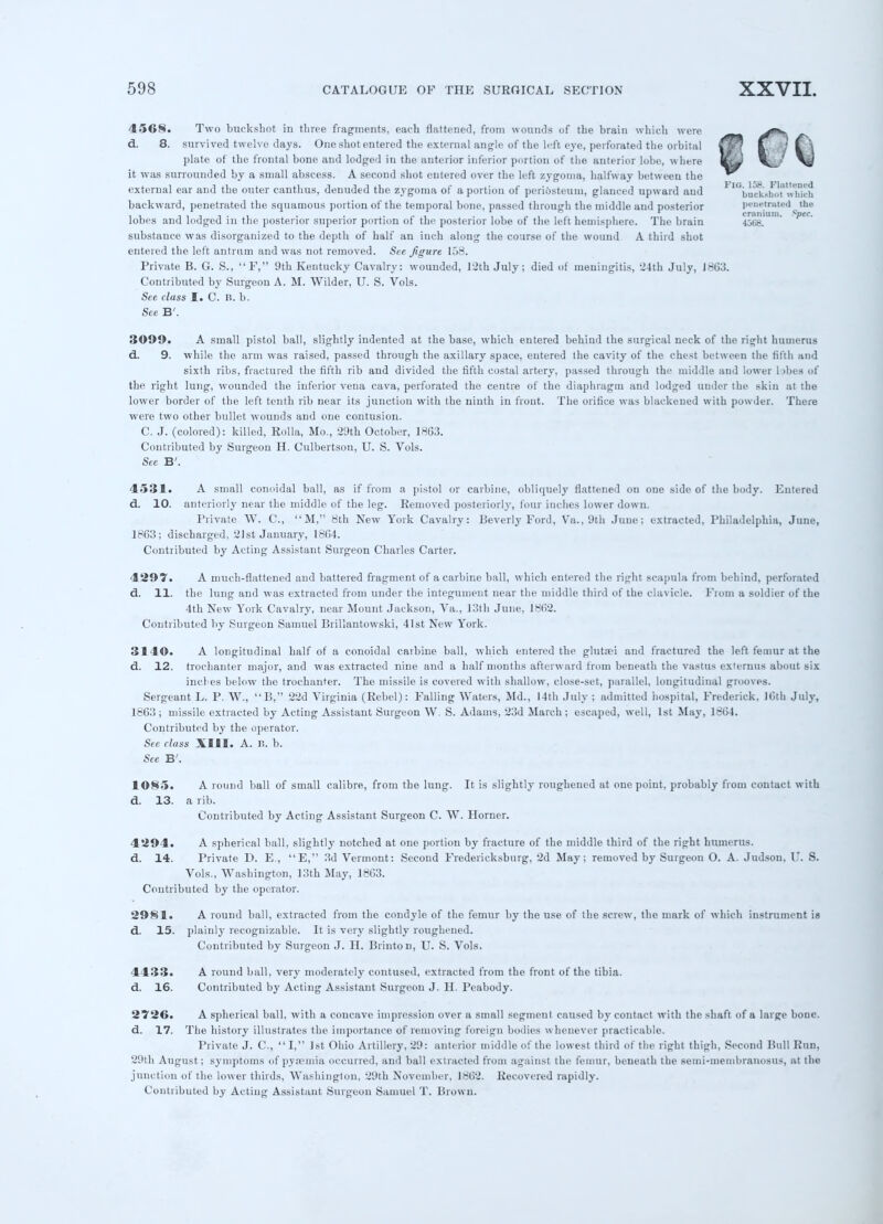 4568. Two buckshot in throe fragments, each flattens d. 8. survived twelve days. One shot entered the externa plate of the frontal bone and lodged in the anterior it was surrounded by a small abscess. A second shot entered external ear and the outer canthus, denuded the zygoma of a backward, penetrated the squamous portion of the temporal be lobes and lodged in the posterior superior portion of the poste substance was disorganized to the depth of half an inch alo: entered the left antrum and was not removed. See figure 158, Private B. G. S., F, 9th Kentucky Cavalry: wounded, Contributed by Surgeon A. M. Wilder, U. S. Vols. See class I. C. R. b. See B'. 1, from wounds of the brain which were I angle of the left eye, perforated the orbital inferior portion of the anterior lobe, where over the left zygoma, halfway between the jortion of periosteum, glanced upward and ne, passed through the middle and posterior rior lobe of the left hemisphere. The brain lg the course of the wound A third shot FIG. 158. Flattened buckshot which penetrated the cranium. cpec. 4068. ith July; died of meningitis, '24th July, 1863. 3099. A small pistol ball, slightly indented at the base, which entered behind the surgical neck of the right humerus d. 9. while the arm was raised, passed through the axillary space, entered the cavity of the chest between the fifth and sixth ribs, fractured the fifth rib and divided the fifth costal artery, passed through the middle and lower bbes of the right lung, wounded the inferior vena cava, perforated the centre of the diaphragm and lodged under the skin at the lower border of the left tenth rib near its junction with the ninth in front. The orifice was blackened with powder. There were two other bullet wounds and one contusion. C. J. (colored): killed, Rolla, Mo., 29th October, 1863. Contributed by Surgeon H. Culbertson, U. S. Vols. See B'. 4531. A small conoidal ball, as if from a pistol or carbine, obliquely flattened on one side of the body. Entered d. 10. anteriorly near the middle of the leg. Removed posteriorly, four inches lower down. Private W. C, M, 8th New York Cavalry: Beverly Ford, Va., 9th June; extracted, Philadelphia, June, 1863; discharged, 21st January, 1864. Contributed by Acting Assistant Surgeon Charles Carter. 4297. A much-flattened and battered fragment of a carbine ball, which entered the right scapula from behind, perforated d. 11. the lung and was extracted from under the integument near the middle third of the clavicle. From a soldier of the 4th New York Cavalry, near Mount Jackson, Va., 13th June, 1862. Contributed by Surgeon Samuel Brillantowski, 41st New York. 3140. A longitudinal half of a conoidal carbine ball, which entered the glutsei and fractured the left femur at the d. 12. trochanter major, and was extracted nine and a half months afterward from beneath the vastus externus about six inches below the trochanter. The missile is covered with shallow, close-set, parallel, longitudinal grooves. Sergeant L. P. W., B, 22d Virginia (Rebel): Falling Waters, Md., 14th July ; admitted hospital, Frederick, 16th July, 1863; missile extracted by Acting Assistant Surgeon W. S. Adams, 23d March; escaped, well, 1st May, 1864. Contributed by the operator. See class XIII. A. li. b. See B'. 1085. A round ball of small calibre, from the lung. It is slightly roughened at one point, probably from contact with d. 13. a rib. Contributed by Acting Assistant Surgeon C. W. Horner. 4294. A spherical ball, slightly notched at one portion by fracture of the middle third of the right humerus, d. 14. Private D. E., E, 3d Vermont: Second Fredericksburg, 2d May; removed by Surgeon O. A. Judson, I'. S. Vols., Washington, 13th May, 1863. Contributed by the operator. 2981. A round ball, extracted from the condyle of the femur by the use of the screw, the mark of which instrument is d. 15. plainly recognizable. It is very slightly roughened. Contributed by Surgeon J. H. Brinton, U. S. Vols. 4433. A round ball, very moderately contused, extracted from the front of the tibia, d. 16. Contributed by Acting Assistant Surgeon J. H. Peabody. 2726. A spherical ball, with a concave impression over a small segment caused by contact with the shaft of a large bone, d. 17. The history illustrates the importance of removing foreign bodies whenever practicable. Private J. C, I, 1st Ohio Artillery, '29: anterior middle of the lowest third of the right thigh, Second Bull Run, 29th August; symptoms of pyaemia occurred, and ball extracted from against the femur, beneath the semi-membranosus, at the junction of the lower thirds, Washington, 29th November, 1862. Recovered rapidly. Contributed by Acting Assistant Surgeon Samuel T. Brown.