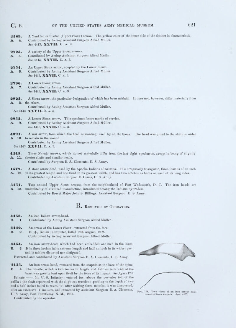 2589. A Yankton or Sisiton (Upper Sioux) arrow. The yellow color of the inner side of the feather is characteristic. A. 4. Contributed by Acting Assistant Surgeon Alfred Miiller. See 4443, XXVII. C. A. 3. 2725. A variety of the Upper Sioux arrows. A. 5. Contributed by Acting Assistant Surgeon Alfred Miiller. See 4443, XXVII. C. A. 3. 2754. An Upper Sioux arrow, adopted by the Lower Sioux. A. 6. Contributed by Acting Assistant Surgeon Alfred Miiller. See 4443, XXVII. C. A. 3. 2796. A Lower Sioux arrow. A. 7. Contributed by Acting Assistant Surgeon Alfred Miiller. See 4443, XXVII. C. a. 3. 2§25. A Sioux arrow, the particular designation of which has been mislaid. It does not, however, dift'er materially from A. 8. the others. Contributed by Acting Assistant Surgeon Alfred Miiller. See 4443, XXVII. C. a. 3. 2855. A Lower Sioux arrow. This specimen bears marks of service. A. 9. Contributed by Acting Assistant Surgeon Alfred Muller. See 4443, XXVII. C. A. 3. 4391. A war arrow, from which the head is wanting, used by all the Sioux. The head was glued to the shaft in order A. 10. to remain in the wound. Contributed by Acting Assistant Surgeon Alfred Muller. See 4443, XXVII. C. a. 3. 4445. Three Navajo arrows, which do not materially differ from the last eight specimens, except in being of slightly A. 11. shorter shafts and smaller heads. Contributed by Surgeon B. A. Clements, U. S. Army. 1577. A stone arrow-head, used by the Apache Indians of Arizona. It is irregularly triangular, three-fourths of an inch A. 12. in its greatest length and one-third in its greatest width, and has two notches as barbs on each of its long sides. Contributed by Assistant Surgeon E. Cones, U. S. Army. 3151. Two unused Upper Sioux arrows, from the neighborhood of Fort Wadsworth, D. T. The iron heads are A. 13. undoubtedly of civilized manufacture, introduced among the Indians by traders. Contributed by Brevet Major John S. Billings, Assistant Surgeon, U. S. Army. B. Removed by Operation. 4453. An iron Indian arrow-head. B. 1. Contributed by Acting Assistant Surgeon Alfred Muller. 4442. An arrow of the Lower Sioux, extracted from the face. B. 2. F. Q., Indian Interpreter, killed 18th August, 1862. Contributed by Acting Assistant Surgeon Alfred Muller. 4454. An iron arrow-head, which had been embedded one inch in the ilium. B. 3. It is three inches in its extreme length and half an inch in its widest part, and is neither distorted nor disfigured. Extracted and contributed by Assistant Surgeon B. A. Clements, U. S. Army. 4455. An iron arrow-head, removed from the scapula at the base of the spine. B. 4. The missile, which is two inches in length and half an inch wide at the base, was greatly bent upon itself by the force of its impact. See figure 178. Private , 5th U. S. Infantry: entered just above the posterior fold of the axilla ; the shaft separated with the slightest traction ; probing to the depth of two and a half inches failed to reveal it; after waiting three months, it was discovered, after an extensive T incision, and extracted by Assistant Surgeon B. A. Clements, £ U. S. Army, Fort Fauntleroy, N. M., 1861. removed from scapula. Spec. 4455. Contributed by the operator.