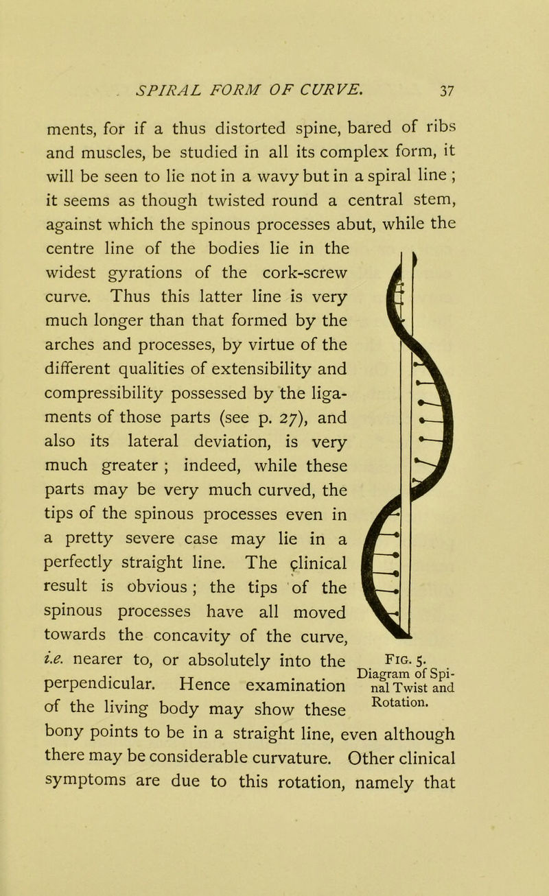 ments, for if a thus distorted spine, bared of ribs and muscles, be studied in all its complex form, it will be seen to lie not in a wavy but in a spiral line ; it seems as though twisted round a central stem, against which the spinous processes abut, while the centre line of the bodies lie in the widest gyrations of the cork-screw curve. Thus this latter line is very much longer than that formed by the arches and processes, by virtue of the different qualities of extensibility and compressibility possessed by the liga- ments of those parts (see p. 27), and also its lateral deviation, is very much greater ; indeed, while these parts may be very much curved, the tips of the spinous processes even in a pretty severe case may lie in a perfectly straight line. The clinical result is obvious; the tips of the spinous processes have all moved towards the concavity of the curve, i.e. nearer to, or absolutely into the Fig. 5. perpendicular. Hence examination nal Twist and of the living body may show these Rotatlon- bony points to be in a straight line, even although there may be considerable curvature. Other clinical symptoms are due to this rotation, namely that