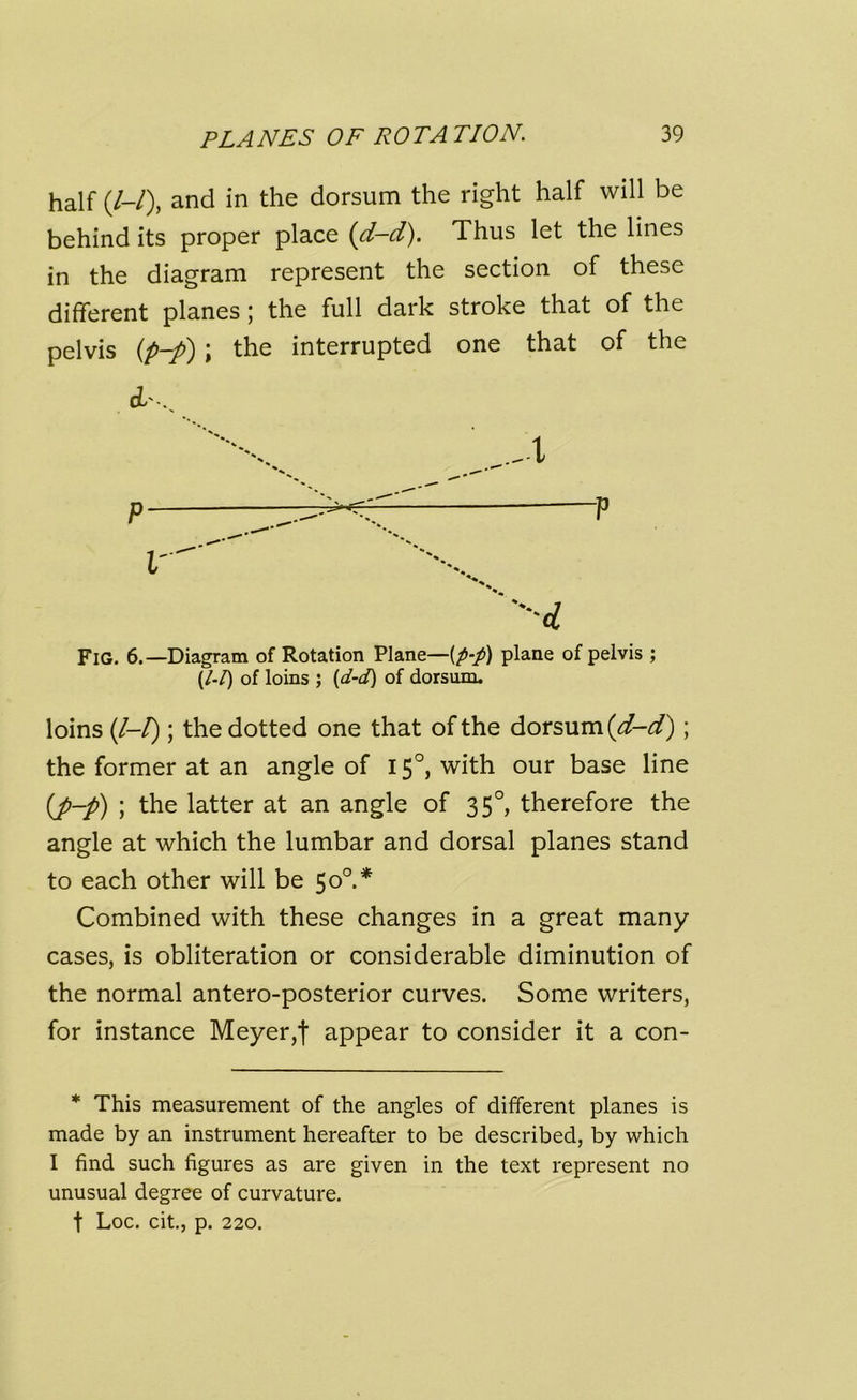 half (/-/), and in the dorsum the right half will be behind its proper place (d-d). Thus let the lines in the diagram represent the section of these different planes ; the full dark stroke that of the pelvis (p-p) ; the interrupted one that of the oL'v -d Fig. 6.—Diagram of Rotation Plane—{p-p) plane of pelvis ; (/-/) of loins ; {d-d) of dorsum, loins (/-/); the dotted one that of the dorsum (d-d); the former at an angle of 15°, with our base line (p-p) ; the latter at an angle of 3 5°, therefore the angle at which the lumbar and dorsal planes stand to each other will be 500.* Combined with these changes in a great many cases, is obliteration or considerable diminution of the normal antero-posterior curves. Some writers, for instance Meyer,f appear to consider it a con- * This measurement of the angles of different planes is made by an instrument hereafter to be described, by which I find such figures as are given in the text represent no unusual degree of curvature, t Loc. cit., p. 220.