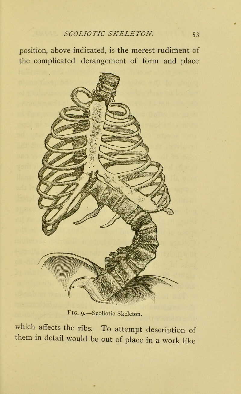 position, above indicated, is the merest rudiment of the complicated derangement of form and place Fig. 9.—Scoliotic Skeleton. which affects the ribs. To attempt them in detail would be out of place description of in a work like