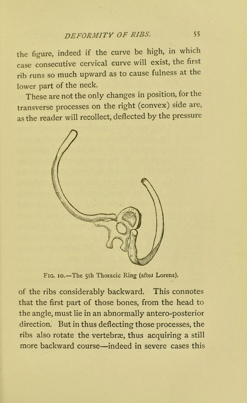 the figure, indeed if the curve be high, in which case consecutive cervical curve will exist, the first rib runs so much upward as to cause fulness at the lower part of the neck. These are not the only changes in position, for the transverse processes on the right (convex) side are, as the reader will recollect, deflected by the pressuie Fig. io.—The 5th Thoracic Ring (aftei Lorenz). of the ribs considerably backward. This connotes that the first part of those bones, from the head to the angle, must lie in an abnormally antero-posterior direction. But in thus deflecting those processes, the ribs also rotate the vertebrae, thus acquiring a still more backward course—indeed in severe cases this