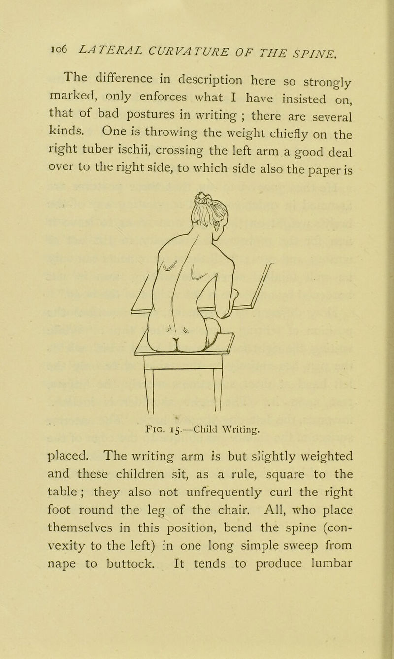 Tlic difference in description here so strongly marked, only enforces what I have insisted on, that of bad postures in writing ; there are several kinds. One is throwing the weight chiefly on the right tuber ischii, crossing the left arm a good deal over to the right side, to which side also the paper is placed. The writing arm is but slightly weighted and these children sit, as a rule, square to the table ; they also not unfrequently curl the right foot round the leg of the chair. All, who place themselves in this position, bend the spine (con- vexity to the left) in one long simple sweep from nape to buttock. It tends to produce lumbar