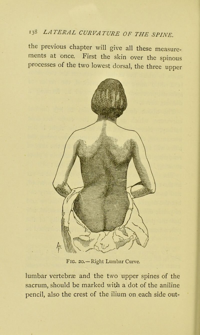 the previous chapter will give all these measure- ments at once. First the skin over the spinous processes of the two lowest dorsal, the three upper lumbar vertebrae and the two upper spines of the sacrum, should be marked with a dot of the aniline pencil, also the crest of the ilium on each side out-