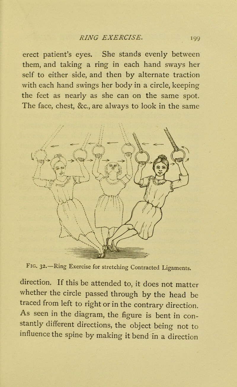 RING EXERCISE. erect patient’s eyes. She stands evenly between them, and taking a ring in each hand sways her self to either side, and then by alternate traction with each hand swings her body in a circle, keeping the feet as nearly as she can on the same spot. The face, chest, &c., are always to look in the same Fig. 32.—Ring Exercise for stretching Contracted Ligaments. direction. If this be attended to, it does not matter whether the circle passed through by the head be traced from left to right or in the contrary direction. As seen in the diagram, the figure is bent in con- stantly different directions, the object being not to influence the spine by making it bend in a direction