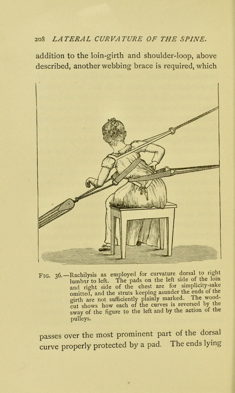 addition to the loin-girth and shoulder-loop, above described, another webbing brace is required, which Fig c?6.—Rachilysis as employed for curvature dorsal to right lumbar to left. The pads on the left side of the lorn and right side of the chest are for simplicity-sake omitted, and the struts keeping asunder the ends of the girth are not sufficiently plainly marked. The wood- cut shows how each of the curves is reversed by the sway of the figure to the left and by the action of the pulleys. passes over the most prominent part of the dorsal curve properly protected by a pad. The ends lying