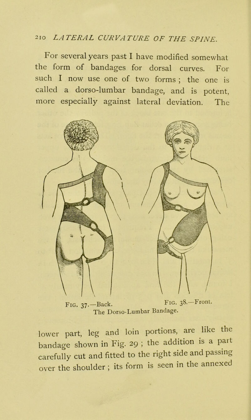 For several years past I have modified somewhat the form of bandages for dorsal curves. For such I now use one of two forms ; the one is called a dorso-lumbar bandage, and is potent, more especially against lateral deviation. The Fig. 37.—Back. Fig. 38.—Front. The Dorso-Lumbar Bandage. lower part, leg and loin portions, are like the bandage shown in Fig. 29 ; the addition is a pail carefully cut and fitted to the right side and passing over the shoulder ; its form is seen in the annexed