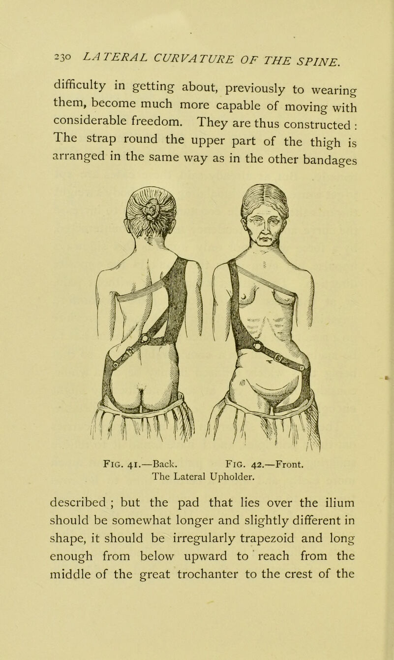 difficulty in getting about, previously to wearing them, become much more capable of moving with consideiable freedom. They are thus constructed : The strap round the upper part of the thigh is arranged in the same way as in the other bandages The Lateral Upholder. described ; but the pad that lies over the ilium should be somewhat longer and slightly different in shape, it should be irregularly trapezoid and long enough from below upward to reach from the middle of the great trochanter to the crest of the