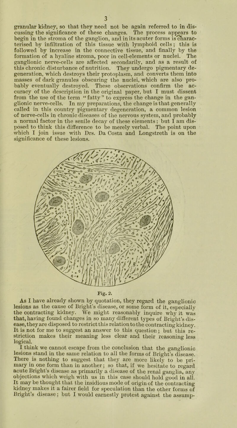 J granular kidney, so that they need not be again referred to in dis- cussing the significance of these changes. The process appears to begin in the stroma of the ganglion, and initsacuter forms is'^arac- terised by infiltration of this tissue with l)Tnphoid cells ; this is followed by increase in the connective tissue, and finally by the formation of a hyaline stroma, poor in cell-elements or nuclei. The ganglionic nerve-cells are affected secondarily, and as a result of this chronic disturbance of nutrition. They undergo pigmentary de- generation, which destroys their protoplasm, and converts them into masses of dark granules obscuring the nuclei, which are also pro- bably eventually destroyed. These observations confirm the ac- curacy of the description in the original paper, but I must dissent fi'om the use of the term “ fatty ” to express the change in the gan- glionic nerve-cells. In my preparations, the change is that generally called in this country pigmentary degeneration, a common lesion of nerve-cells in chronic diseases of the nervous system, and probably a normal factor in the senile decay of these elements; but I am dis- posed to think this difference to be merely verbal. The point upon which I join issue with Drs. Da Costa and Longstreth is on the significance of these lesions. As I have already shown by quotation, they regard the ganglionic lesions as the cause of Bright's disease, or some form of it, especiallv the contracting kidney. We might reasonably inquire why it was that, having found changes in so many different types of Bright’s dis- ease, they are disposed to restrict this relation to the contracting kidney. It is not for me to suggest an answer to this question; but this re- striction makes their meaning less clear and their reasoning less logical. I think we cannot escape from the conclusion that the ganglionic lesions stand in the same relation to all the forms of Bright’s disease. There _ is nothing to suggest that they are more likely to be pri- mary in one form than in another; so that, if we hesitate to regard acute Bright’s disease as primarily a disease of tlie renal ganglia, any objections which weigh with us in this case should hold good in all. It may be thought that the insidious mode of origin of the contracting kidney makes it a fairer field for speculation than the other forms of Bright’s disease; but I would earnestly protest against the assump-