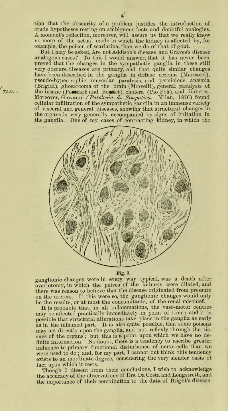 tion that the obscurity of a problem justifies the introduction of crude h}rpotheses resting on ambiguous facts and doubtful analogies. A moment’s reflection, moreover, will assure us that we really know no more of the actual mode in which the kidney is affected by, for example, the poison of scarlatina, than we do of that of gout. But I may be asked. Are not Addison’s disease and Graves’s disease analogous cases ? To this I would answer, that it has never been proved that the changes in the sympathetic ganglia in these still very obscure diseases are primary, and that quite similar changes have been described in the ganglia in diffuse eczema (Marcacci), pseudo-hypertrophic muscular paralysis, and pernicious anaemia (Brigidi), gliosarcoma of the brain (Morselli), general paralysis of the insane (Ponicare and Boaeet), cholera (Pio Foa), and diabetes. Moreover, Giovanni (Patologia di Simpatica. Milan, 1876) found cellular infiltration of the s}^mpathetic ganglia in an immense variety of visceral and general diseases, showing that structural changes in the organs is very generally accompanied by signs of irritation in the ganglia. One of my cases of contracting kidney, in which the Pig. 3. ganglionic changes were in every way t}^ical, was a death after ovariotomy, in which the pelves of the kidneys were dilated, and there was reason to believe that the disease originated from pressure on the ureters. If this were so, the ganglionic changes would only be the results, or at most the concomitants, of the renal mischief. It is probable that, in all inflammations, the vaso-motor centres may be affected practically immediately in point of time ; and it is possible that structm’al alterations take place in the gangha as early as in the inflamed part. It is also quite possible, that some poisons may act directly upon the gangha, and not reflexly through the tis- sues of the organs; but this is a point upon which we have no de- finite information. No doubt, there is a tendency to ascribe greater influence to primary functional disturbance of nerve-cells than we were used to do ; and, for my part, I cannot but think this tendency exists to an inordinate degree, considering the very slender basis of fact upon which it rests. Though I dissent from their conclusions, I wish to acknowledge the accuracy of the observations of Drs. Da Costa and Longstreth, and the importance of their contribution to the data of Bright’s disease.