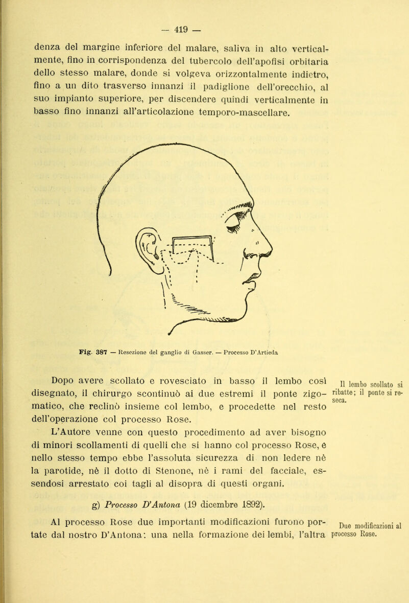 denza del margine inferiore del malare, saliva in alto vertical- mente, fino in corrispondenza del tubercolo dell'apofisi orbitaria dello stesso malare, donde si volgeva orizzontalmente indietro, fino a un dito trasverso innanzi il padiglione dell'oreccliio, al suo impianto superiore, per discendere quindi verticalmente in basso fino innanzi all'articolazione temporo-mascellare. Dopo avere scollato e rovesciato in basso il lembo così ^^^^^ scollato si disegnato, il chirurgo scontinuò ai due estremi il ponte zigo- ribatte; il ponto si re- seca. matico, che reclinò insieme col lembo, e procedette nel resto dell'operazione col processo Rose. L'Autore venne con questo procedimento ad aver bisogno di minori scollamenti di quelli che si hanno col processo Rose, e nello stesso tempo ebbe l'assoluta sicurezza di non ledere nè la parotide, nè il dotto di Stenone, nè i rami del facciale, es- sendosi arrestato coi tagli al disopra di questi organi. g) Processo UAntona (19 dicembre 1892). Al processo Rose due importanti modificazioni furono por- modificazioni al tate dal nostro D'Antona: una nella formazione dei lembi, l'altra processo Rose.