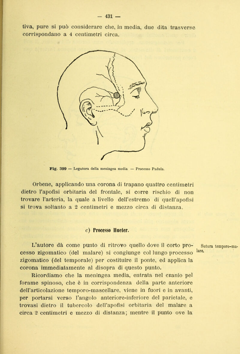 tiva, pure si può considerare clie, in media, due dita trasverse corrispondano a 4 centimetri circa. Fig. 399 — Legatura della meningea media — Processo Padula. Orbene, applicando una corona di trapano quattro centimetri dietro l'apoflsi orbitaria del frontale, si corre rischio di non trovare l'arteria, la quale a livello dell'estremo di quell'apofisi si trova soltanto a 2 centimetri e mezzo circa di distanza. e) Processo Hueter. L'autore dà come punto di ritrovo quello dove il corto prò- Sutura temporo-i cesso zigomatico (del malare) si congiunge col lungo processo zigomatico (del temporale) per costituire il ponte, ed applica la corona immediatamente al disopra di questo punto. Ricordiamo che la meningea media, entrata nel cpanio pel forame spinoso, che è in corrispondenza della parte anteriore dell'articolazione temporo-mascellare, viene in fuori e in avanti, per portarsi verso l'angolo anteriore-inferiore del parietale, e trovasi dietro il tubercolo dell'apofisi orbitaria del malare a circa 2 centimetri e mezzo di distanza; mentre il punto ove la