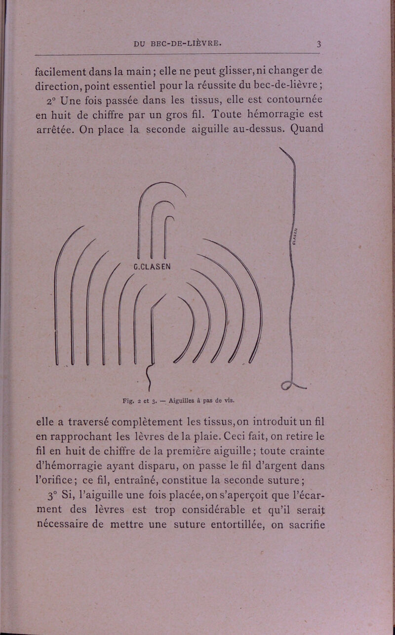 facilement dans la main ; elle ne peut glisser, ni changer de direction, point essentiel pour la réussite du bec-de-lièvre ; 2° Une fois passée dans les tissus, elle est contournée en huit de chiffre par un gros fil. Toute hémorragie est arrêtée. On place la seconde aiguille au-dessus. Quand elle a traversé complètement les tissus, on introduit un fil en rapprochant les lèvres de la plaie. Ceci fait, on retire le fil en huit de chiffre de la première aiguille ; toute crainte d’hémorragie ayant disparu, on passe le fil d’argent dans l’orifice; ce fil, entraîné, constitue la seconde suture; 3° Si, l’aiguille une fois placée, on s’aperçoit que l’écar- ment des lèvres est trop considérable et qu’il serait nécessaire de mettre une suture entortillée, on sacrifie