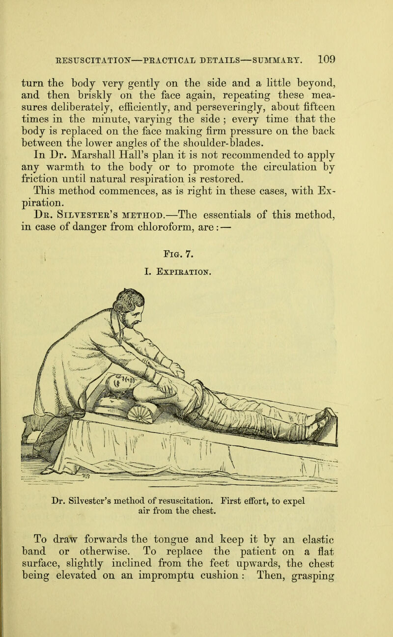 turn the body very gently on the side and a little beyond, and then briskly on the face again, repeating these mea- sures deliberately, efficiently, and perseveringly, about fifteen times in the minute, varying the side ; every time that the body is replaced on the face making firm pressure on the back between the lower angles of the shoulder-blades. In Dr. Marshall Hall's plan it is not recommended to apply any warmth to the body or to promote the circulation by friction until natural respiration is restored. This method commences, as is right in these cases, with Ex- piration. Dr. Silvester's method.—The essentials of this method, in case of danger from chloroform, are: — Fig. 7. i. expieation. Dr. Silvester's method of resuscitation. First effort, to expel air from the chest. To draw forwards the tongue and keep it by an elastic band or otherwise. To replace the patient on a flat surface, slightly inclined from the feet upwards, the chest being elevated on an impromptu cushion : Then, grasping