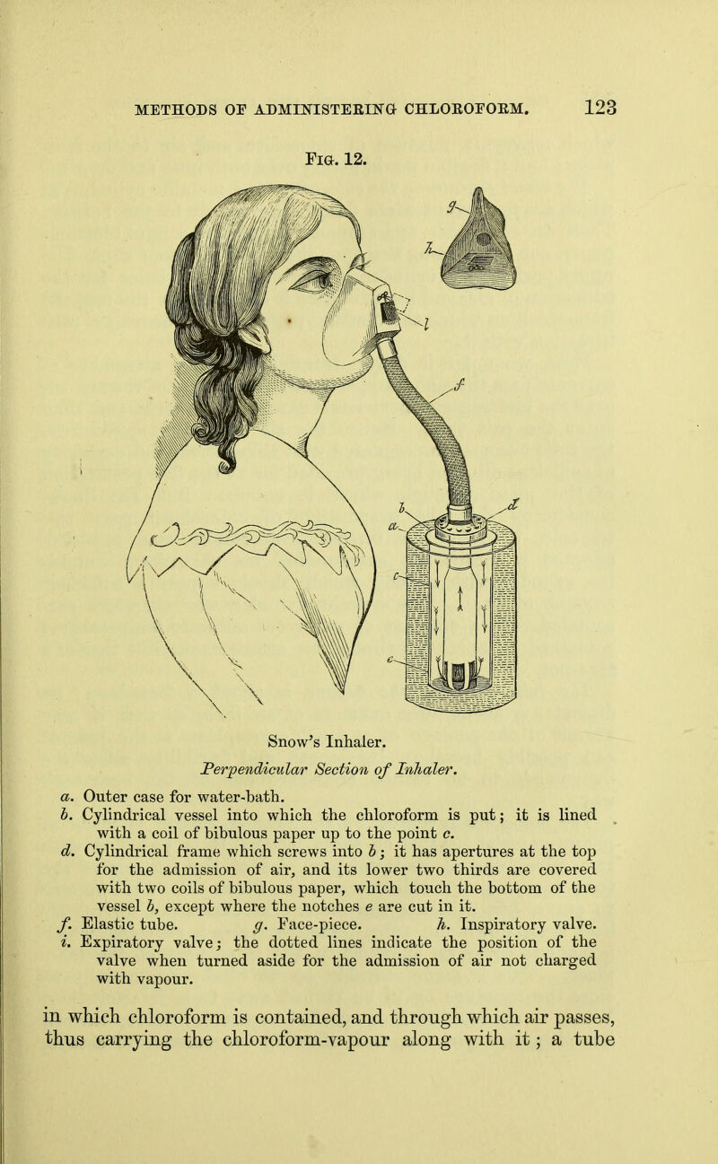 Fig. 12. Snow's Inhaler. Perpendicular Section of Inhaler. a. Outer case for water-bath. b. Cylindrical vessel into which the chloroform is put; it is lined with a coil of bibulous paper up to the point c. d. Cylindrical frame which screws into b; it has apertures at the top for the admission of air, and its lower two thirds are covered with two coils of bibulous paper, which touch the bottom of the vessel b, except where the notches e are cut in it. f. Elastic tube. g. Face-piece. 7t. Inspiratory valve. i. Expiratory valve; the dotted lines indicate the position of the valve when turned aside for the admission of air not charged with vapour. in which chloroform is contained, and through which air passes, thus carrying the chloroform-vapour along with it; a tube