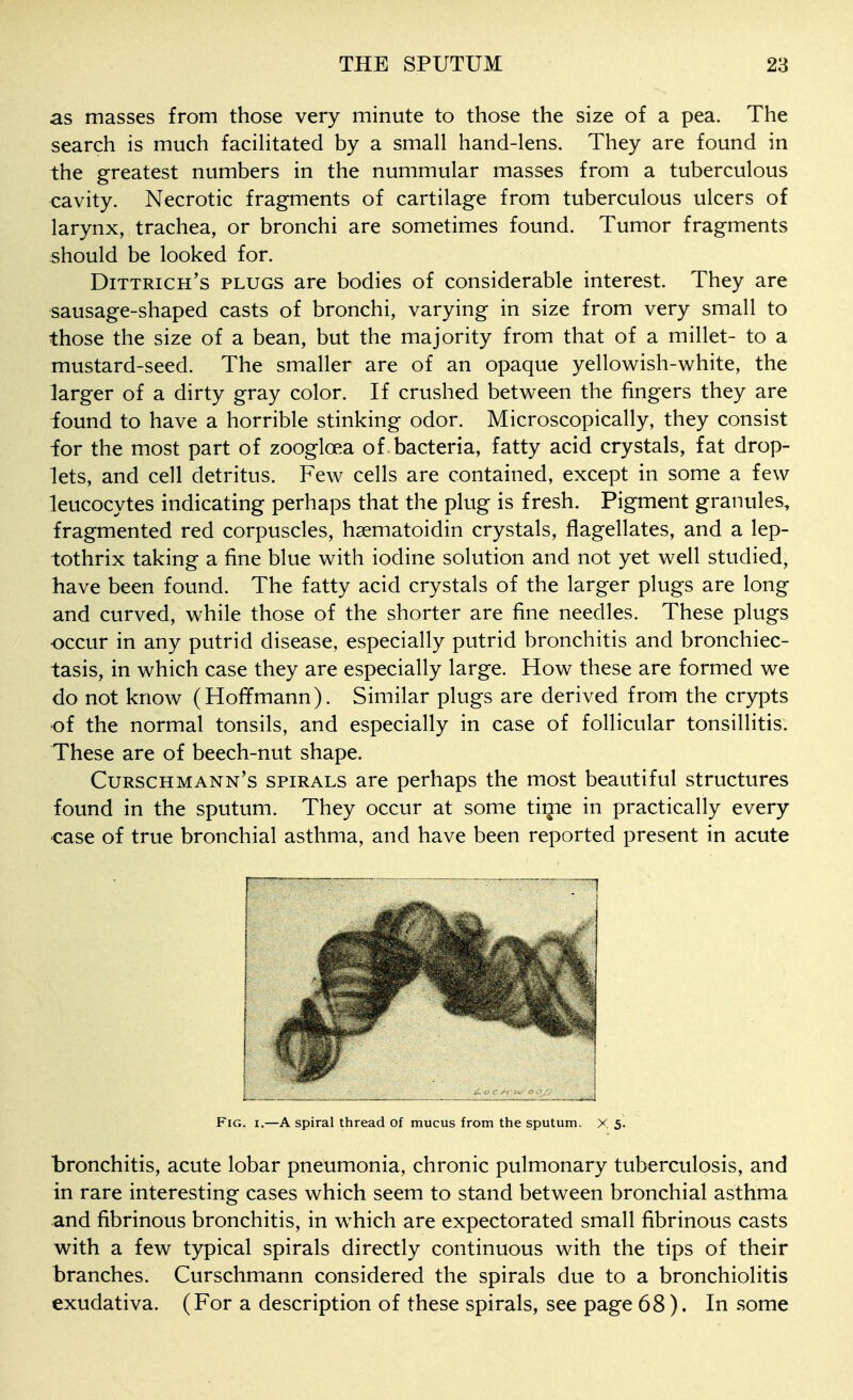 as masses from those very minute to those the size of a pea. The search is much facihtated by a small hand-lens. They are found in the greatest numbers in the nummular masses from a tuberculous cavity. Necrotic fragments of cartilage from tuberculous ulcers of larynx, trachea, or bronchi are sometimes found. Tumor fragments should be looked for. Dittrich's plugs are bodies of considerable interest. They are sausage-shaped casts of bronchi, varying in size from very small to those the size of a bean, but the majority from that of a millet- to a mustard-seed. The smaller are of an opaque yellowish-white, the larger of a dirty gray color. If crushed between the fingers they are found to have a horrible stinking odor. Microscopically, they consist -for the most part of zoogloea of bacteria, fatty acid crystals, fat drop- lets, and cell detritus. Few cells are contained, except in some a few leucocytes indicating perhaps that the plug is fresh. Pigment granules, fragmented red corpuscles, hgematoidin crystals, flagellates, and a lep- tothrix taking a fine blue with iodine solution and not yet well studied, have been found. The fatty acid crystals of the larger plugs are long and curved, while those of the shorter are fine needles. These plugs ■occur in any putrid disease, especially putrid bronchitis and bronchiec- tasis, in which case they are especially large. How these are formed we do not know (Hoffmann). Similar plugs are derived from the crypts of the normal tonsils, and especially in case of follicular tonsillitis. These are of beech-nut shape. Curschmann's spirals are perhaps the most beautiful structures found in the sputum. They occur at some tigie in practically every case of true bronchial asthma, and have been reported present in acute Fig. I.—A spiral thread of mucus from the sputum. X 5^ bronchitis, acute lobar pneumonia, chronic pulmonary tuberculosis, and in rare interesting cases which seem to stand between bronchial asthma and fibrinous bronchitis, in which are expectorated small fibrinous casts with a few typical spirals directly continuous with the tips of their branches. Curschmann considered the spirals due to a bronchiolitis exudativa. (For a description of these spirals, see page 68). In some
