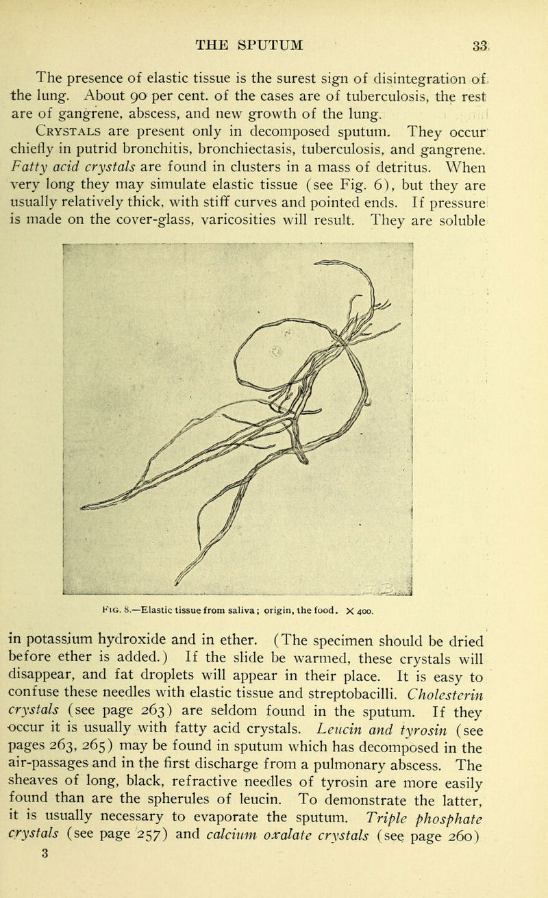 The presence of elastic tissue is the surest sign of disintegration of. the lung. About 90 per cent, of the cases are of tuberculosis, the rest are of gangrene, abscess, and new growth of the lung. 1 Crystals are present only in decomposed sputum. They occur chiefly in putrid bronchitis, bronchiectasis, tuberculosis, and gangrene. Fatty acid crystals are found in clusters in a mass of detritus. When very long they may simulate elastic tissue (see Fig. 6), but they are usually relatively thick, with stiff curves and pointed ends. If pressure is made on the cover-glass, varicosities will result. They are soluble Fig. 8.—Elastic tissue from saliva; origin, the food. X 400. in potassium hydroxide and in ether. (The specimen should be dried before ether is added.) If the slide be warmed, these crystals will disappear, and fat droplets will appear in their place. It is easy to confuse these needles with elastic tissue and streptobacilli. Cholesterin crystals (see page 263) are seldom found in the sputum. If they occur it is usually with fatty acid crystals. Leucin and tyrosin (see pages 263, 265) may be found in sputum which has decomposed in the air-passages and in the first discharge from a pulmonary abscess. The sheaves of long, black, refractive needles of tyrosin are more easily found than are the spherules of leucin. To demonstrate the latter, it is usually necessary to evaporate the sputum. Triple phosphate crystals (see page 257) and calcium oxalate crystals (see page 260) 3