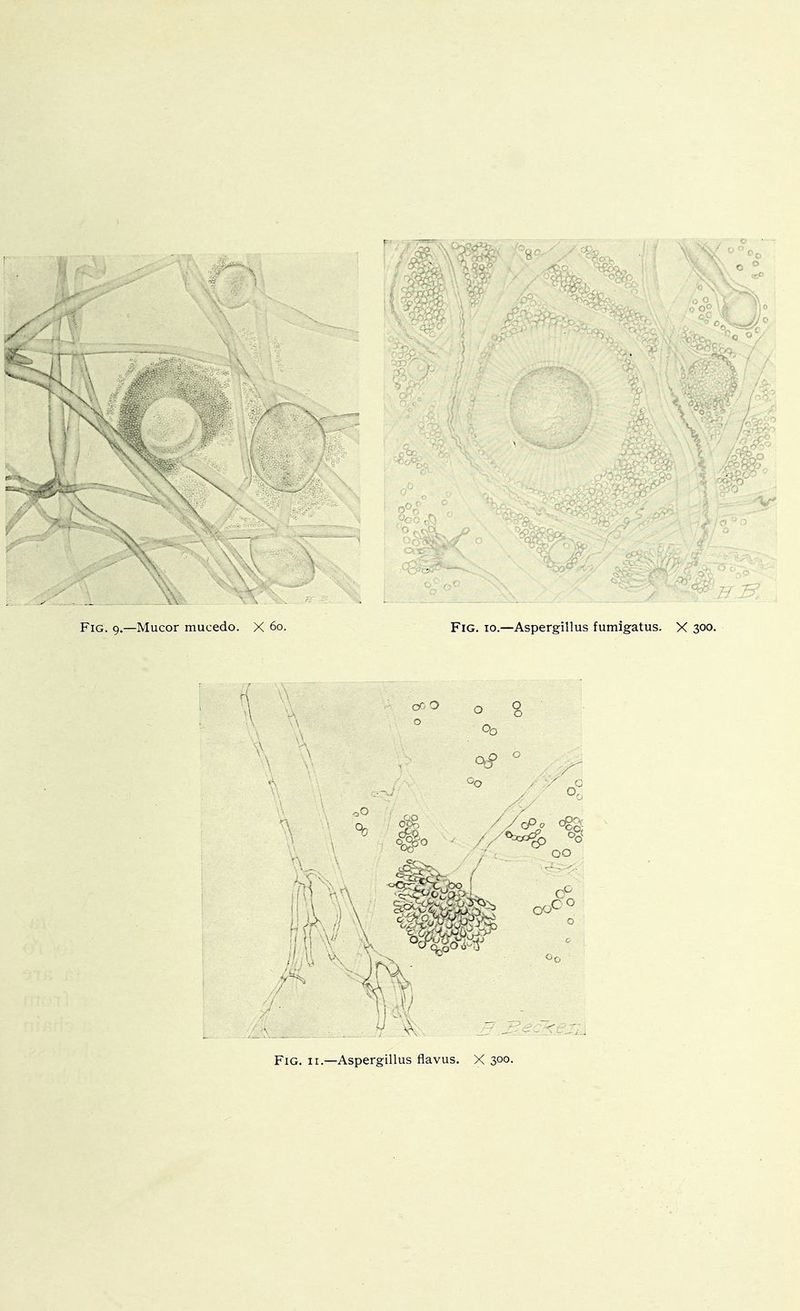 V- Fig. 9.—Mucor mucedo. X 60. Fig. 10.—Aspergillus fumigatus. X 300. cr.O o Oo .-,0 .' - ' #0 --^ ^' 00 Fig. II.—Aspergillus flavus. X 300-