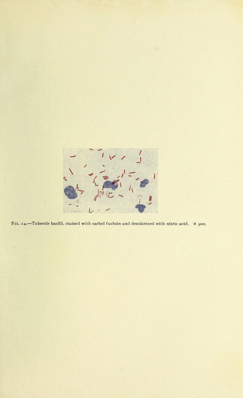\ ^ ^ ■ .1 Fig. 14.—Tubercle bacilli, stained with carbol fuchsin and decolorized with nitric acid. X 900.
