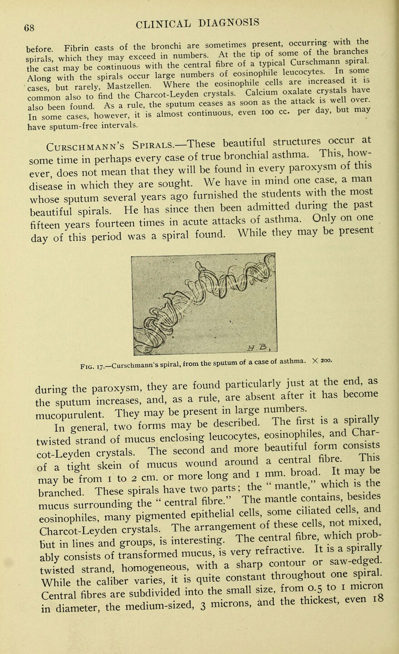before Fibrin casts of the bronchi are sometimes present, occurring- with the ommon llso to'find the Charcot-Leyden crystals. Calc.um oxalate crys^a have also been found. As a rule, the sputum ceases as soon as the attack is In some cases, however, it is almost continuous, even .00 cc. per day, but may have sputum-free intervals. CuRSCHMANN's SpiRALS.-These beautiful structures occur at some time in perhaps every case of true broirchial asthma. This, how- ever does not mean that they will be found in every paroxysm of this disease in which they are sought. We have in mind one case a man whose sputum several years ago furnished the students with the mos beautiful spirals. He has since then been admitted durmg the past fifteen years fourteen times in acute attacks of asthma. Only on one day of this period was a spiral found. While they may be present Fic. i7.-Curschmann's spiral, from the sputum of a case of asthma. X 200. during the paroxysm, they are found particularly just at the end, as ?he sputum'increases. and, as a rule, are absent after it has become mucopurulent. They may be present in large numbers In general, two forms may be described. The first is a spirally twisted strand of mucus enclosing leucocytes, eosinophiles, and Char- Ileyden crystals. The second and more beauuM form cons;^ of a tight skein of mucus wound around a nt-^^l/^^; mav be from i to 2 cm. or more long and i mm. broad. It may be branched These spirals have two parts; the  mantle, which is the mucus surrounding the  central fibre. The mantle contains, besides Tsn^philes, many'pigmented epithelial cells, some ^^^^^f^^'X^^ Charcot-Leyden crystals. The arrangement of these cells, ot mixed, Mnefand groups, is interesting. The central fibre which p«>b- ablv consists of transformed mucus, is very refractive. It is a spiially twtS strand homogeneous, with a sharp contour or saw-edged. WhS'thrcaJber vaifes, it is quite constant th-gh-t one ^^^^^^^^ Central fibres are subdivided into the small size 0-5 ^o i micron Tn diameter, the medium-sized, 3 microns, and the thickest, even 18