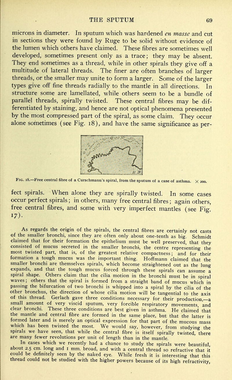 microns in diameter. In sputum which was hardened en masse and cut in sections they were found by Ruge to be soHd without evidence of the lumen which others have claimed. These fibres are sometimes well developed, sometimes present only as a trace; they may be absent. They end sometimes as a thread, while in other spirals they give off a multitude of lateral threads. The finer are often branches of larger threads, or the smaller may unite to form a larger. Some of the larger types give off fine threads radially to the mantle in all directions. In structure some are lamellated, while others seem to be a bundle of parallel threads, spirally twisted. These central fibres may be dif- ferentiated by staining, and hence are not optical phenomena presented by the most compressed part of the spiral, as some claim. They occur alone sometimes (see Fig. i8), and have the same significance as per- .^..^.M^m Fig. i8.—Free central fibre of a Curschmann's spiral, from the sputum of a case of asthma. X 200. feet spirals. When alone they are spirally twisted. In some cases occur perfect spirals; in others, many free central fibres; again others, free central fibres, and some with very imperfect mantles (see Fig. 17). As regards the origin of the spirals, the central fibres are certainly noi casts of the smaller bronchi, since they are often only about one-tenth as big. Schmidt claimed that for their formation the epithelium mUst be well preserved, that they consisted of mucus secreted in the smaller bronchi, the centre representing the most twisted part, that is, of the greatest relative compactness; and for their formation a tough mucus was the important thing. Hoffmann claimed that the smaller bronchi are themselves spirals, which become straightened out as the lung expands, and that the tough mucus forced through these spirals can assume a spiral shape. Others claim that the cilia motion in the bronchi must be in spiral waves; others that the spiral is formed from a straight band of mucus which in passing the bifurcation of two bronchi is whipped into a spiral by the cilia of the other bronchus, the direction of whose cilia motion will be tangential to the axis of this thread. Gerlach gave three conditions necessary for their production,—a small amount of very viscid sputum, very forcible respiratory movements, and clear bronchi. These three conditions are best given in asthma. He claimed that the mantle and central fibre are formed in the same place, but that the latter is formed later and is merely an optical expression for that part of the mucous mass which has been twisted the most. We would say, however, from studying the spirals we have seen, that while the central fibre is itself spirally twisted, there are many fewer revolutions per unit of length than in the mantle. In cases which we recently had a chance to study the spirals were beautiful, about 2.5 cm. long and i mm. broad, and with a central thread so refractive that it could be definitely seen by the naked eye. While fresh it is interesting that this thread could not be studied with the higher powers because of its high refractivity,