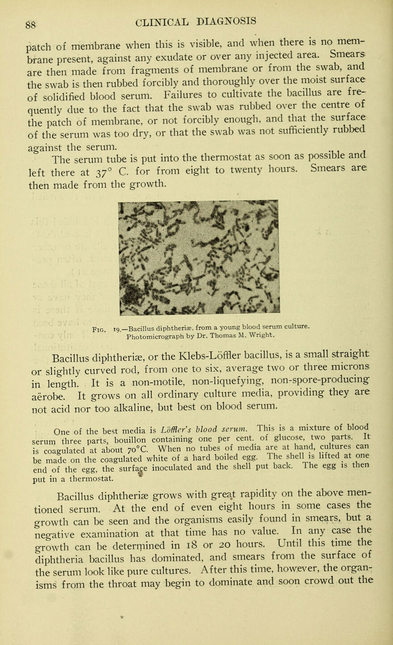 patch of membrane when this is visible, and when there is no mem- brane present, against any exudate or over any injected area. Smears are then made from fragments of membrane or from the swab, and the swab is then rubbed forcibly and thoroughly over the moist surface of solidified blood serum. Failures to cultivate the bacillus are fre- quently due to the fact that the swab was rubbed over the centre of the patch of membrane, or not forcibly enough, and that the surface of the serum was too dry, or that the swab was not sufficiently rubbed against the serum. The serum tube is put into the thermostat as soon as possible and left there at 37° C. for from eight to twenty hours. Smears are then made from the growth. Pjg. 19—Bacillus diphtheria, from a young blood serum culture. -:■;.,) Photomicrograph by Dr. Thomas M. Wright. Bacillus diphtherise, or the Klebs-Loffler bacillus, is a small straight or slightly curved rod, from one to six, average two or three microns in length. It is a non-motile, non-liquefying, non-spore-producing aerobe. It grows on all ordinary culture media, providing they are not acid nor too alkaline, but best on blood serum. One of the best media is LoMcr's blood scrum. This is a mixture of blood serum three parts, bouillon containing one per cent, of glucose, two parts. It is coagulated at about 70°C. When no tubes of media are at hand, cultures can be made on the coagulated white of a hard boiled egg. The shell is lifted at one end of the egg, the surface inoculated and the shell put back. The egg is then put in a thermostat. Bacillus diphtheria grows with great rapidity on the above men- tioned serum. At the end of even eight hours in some cases the growth can be seen and the organisms easily found in smears, but a negative examination at that time has no value. In any case the growth can be determined in 18 or 20 hours. Until this time the diphtheria bacillus has dominated, and smears from the surface of the serum look like pure cultures. After this time, however, the organ- isms from the throat may begin to dominate and soon crowd out the