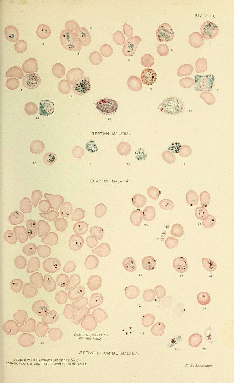 STAINED WITH HASTING'S MODIFICATION OF ROMANOWSKI'S STAIN. ALL DRAWN TO SAME SCALE. F. S. Lockwood.