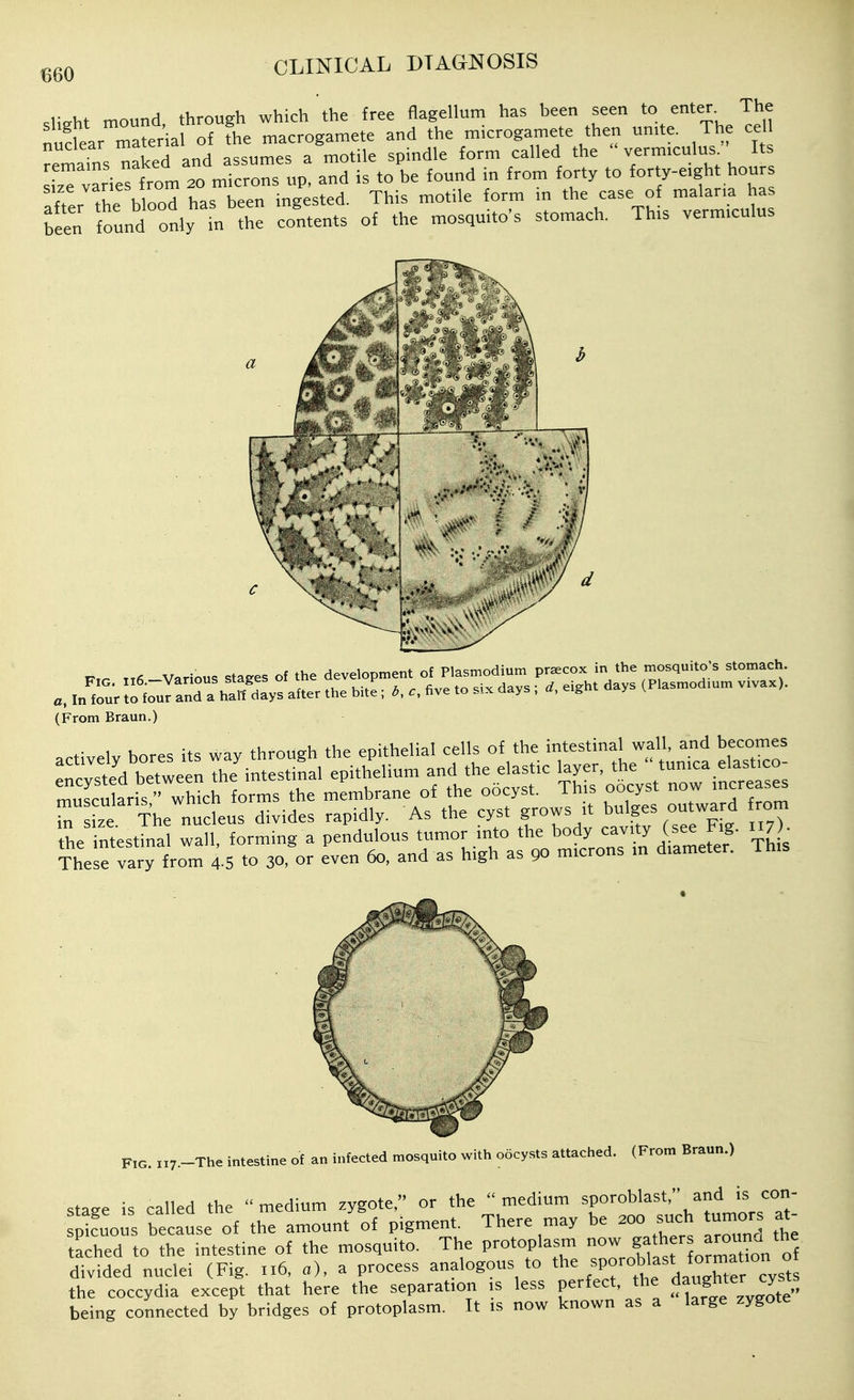 slight mound, through which the free flagellum has been seen to enter. The l,;r material of the macrogamete and the m.crogamete then unite. The cell remains Xd and ssumes a motile spindle form called the  vermiculus. • Its sfzTvaries from 20 microns up, and is to be found in from forty to forty-e.ght hou (fr rteb nod has been ingested. This motile form in the case of malaria has blen found only ^n the contents of the mosquito's stomach. This vermiculus ir.^ Various staees of the development of Plasmodium precox in the mosquito's stomach, in four ;l~„y:nd a htrf^d^s after the W.e ; K c, five .0 si. days ; eight days (Plasmodium viva.,. (From Braun.) .rtivelv bores its way through the epithelial cells of the intestinal wall, and becomes the intestinal wall, forming a pendulous tumor into the body cavity (see Fig. 117 ^ These vary from 4-5 to 30 or even 60, and as high as 90 microns m diameter. Th.s FlG. i,7.-The intestine of an infected mosquito with oocysts attached. (From Braun.) stasre is called the medium zygote, or the medium sporoblast, and is con- c'uois be':! of the amount of pigment^ There may be .00 such „ at- tached to the intestine of the mosquito. The protoplasm now gathers around tne ^vX nuclei (Fig. t.6, a), a process analogous to *e sp—^^^^^^^^ the coccydia except that here the separation is less P«f'=<=t- '''^ laree zygote'' being connected by bridges of protoplasm. It is now known as a large zygote