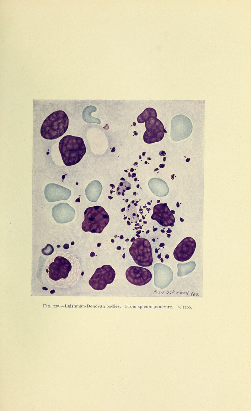 Fig. 120.—Leishman-Donovan bodies. From splenic puncture. X 1200.