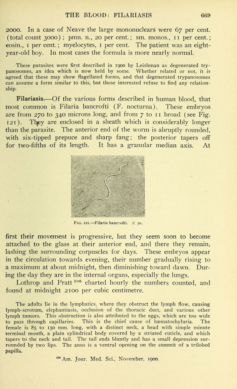 2000. In a case of Neave the large mononuclears were 67 per cent, (total count 3000) ; pmn. n., 20 per cent.; sm. monos., 11 per cent.; eosin., i per cent.; myelocytes, i per cent. The patient was an eight- year-old boy. In most cases the formula is more nearly normal. These parasites were first described in 1900 by Leishman as degenerated try- panosomes, an idea which is now held by some. Whether related or not, it is agreed that these may show flagellated forms, and that degenerated trypanosomes can assume a form similar to this, but those interested refuse to find any relation- ship. Filariasis.—Of the various forms described in human blood, that most common is Filaria bancrofti (F. nocturna). These embryos are from 270 to 340 microns long, and from 7 to 11 broad (see Fig. 121). Tl^ey are enclosed in a sheath which is considerably longer than the parasite. The anterior end of the worm is abruptly rounded, with six-tipped prepuce and sharp fang; the posterior tapers off for two-fifths of its length. It has a granular median axis. At Fig. 121.—Filaria bancrofti. X 50. first their movement is progressive, but they seem soon to become attached to the glass at their anterior end, and there they remain, lashing the surrounding corpuscles for days. These embryos appear in the circulation towards evening, their number gradually rising to a maximum at about midnight, then diminishing toward dawn. Dur- ing the day they are in the internal organs, especially the lungs. Lothrop and Pratt charted hourly the numbers counted, and found at midnight 2100 per cubic centimetre. The adults lie in the lymphatics, where they obstruct the lymph flow, causing lymph-scrotum, elephantiasis, occlusion of the thoracic duct, and various other lymph tumors. This obstruction is also attributed to the eggs, which are too wide to pass through capillaries. This is the chief cause of hsematochyluria. The female is 85 to 150 mm. long, with a distinct neck, a head with simple minute terminal mouth, a plain cylindrical body covered by a striated cuticle, and which tapers to the neck and tail. The tail ends bluntly and has a small depression sur- rounded by two lips. The anus is a ventral opening on the summit of a trilobed papilla. ^°®Am. Jour. Med. Sci., November, 1900.
