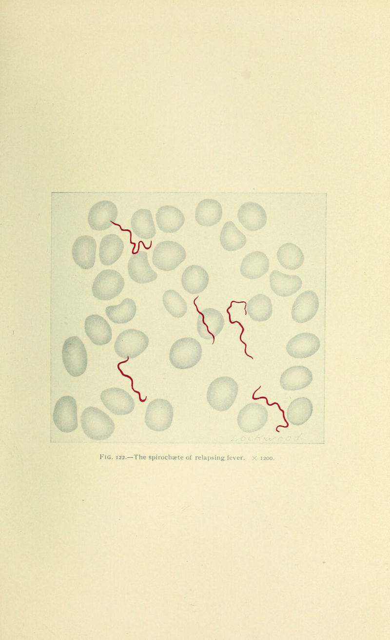 Fig. 122.—The spirochaete of relapsing fever. X 1200.