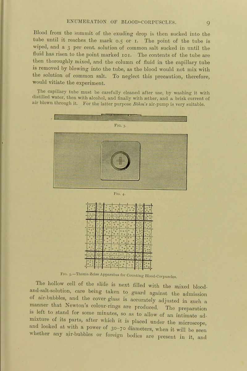 ENUMERATION OF BLOOD-CORPUSCLES. IIIoocl from the auimnit of tlio exuding dro]) i.s then sucked into the tube until it reaches the mark 0.5 or i. The point of the tube is wiped, and a 3 per cent, solution of common salt sucked in until the fluid has risen to the point marked loi. The contents of the tube are then thoroughly mixed, and the column of fluid in the capillary tube is removed by blowing into the tube, as the blood would not mix with the solution of common salt. To neglect this precaution, therefore, would vitiate the experiment. Ihe capillary tube must bo carefully cleaned after use, by washing it with distilled water, then with alcohol, and finally with aether, and a brisk current of air blown through it. For the latter purpose Bohni’s air-pump is very suitable. < 0 “ 0 0 «• {”0 P 00 ® 0 e «* 0 0 r p % . 0 »'' e ©o 9 ° 0 ® 0 0 ® c 0 0 e 0 a D e  e 0 ^ 0 Oo® ^ 0 a 0 e u ® 0 0 0 0 0 0 0 0 ®o 0 c 0 « P 0  0 0 0 e 0 0 0 D 0 e Of, 0 • ® 0 0 0 0 o 0 •0 P 0 0 0 wo* » 0 0 0' « 0 0 « 0 e e 00 ® o« « 0 ® e r> « • *. 00* • 0 9 0 « * 0 0 0 0 e 0 0 ■  0 • «.o 9 ® • n 0 0 e^o Fio. 5.-Thoni.vZoi.ss Appar.itus for Counting Blood-Corpuscles. The hollow cell of the slide is next filled with the mixed blood- and-salt-solution, care being taken to guard against the admission of air-bubbles, and the cover glass is accurately adjusted in such a manner that Newton’s colour-rings are produced. The preparation IS left to stand for some minutes, so as to allow of an intimate ad- mixture of Its parts, after which it is placed under the microscope, and looked at with a power of 30-70 diameters, when it will be seen whether any air-bubbles or foreign bodies are present in it, and