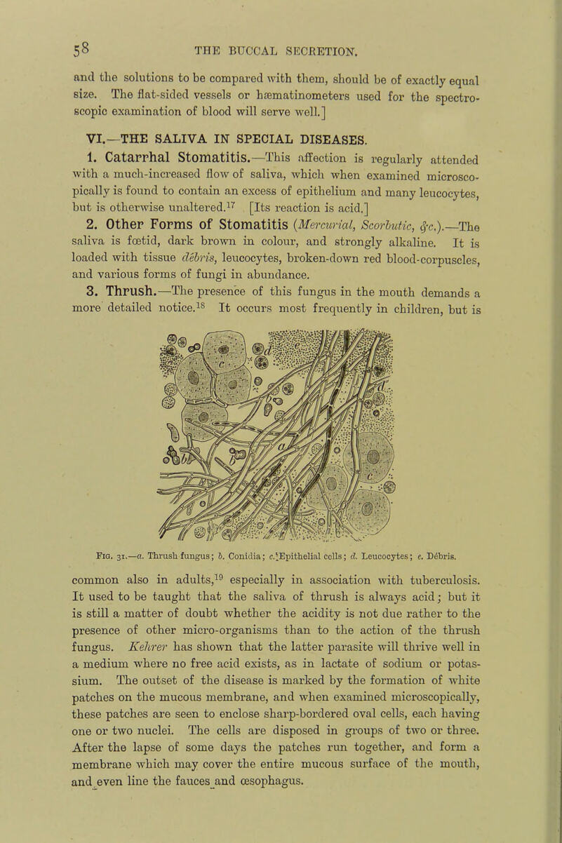and the solutions to be compared with them, should be of exactly equal size. The flat-sided vessels or haematinometers used for the spectro- scopic examination of blood will serve well.] VI.—THE SALIVA IN SPECIAL DISEASES. 1. Catarrhal Stomatitis.—This affection is regularly attended with a much-increased flow of saliva, which when examined microsco- pically is found to contain an excess of epithelium and many leucocytes, but is otherwise unaltered.[Its reaction is acid.] 2. Other Forms of Stomatitis {Mercurial, Scorbutic, ^-c.).-The saliva is foetid, dark brown in colour, and strongly alkaline. It is loaded with tissue debris, leucocytes, broken-down red blood-corpuscles, and various forms of fungi in abundance. 3. Thrush.—The presence of this fungus in the mouth demands a more detailed notice.occurs most frequently in children, but is Fig. 31.—a. Thrush fungus; J. Conidia; c.‘Epithelial colls; d Leucocytes; e. Debris. common also in adults,^® especially in association with tuberculosis. It used to be taught that the saliva of thrush is always acid; but it is still a matter of doubt whether the acidity is not due rather to the presence of other micro-organisms than to the action of the thrush fungus. Kehrer has shown that the latter parasite wiU thrive well in a medium where no free acid exists, as in lactate of sodium or potas- sium. The outset of the disease is marked by the formation of white patches on the mucous membrane, and when examined microscopically, these patches are seen to enclose sharp-bordered oval cells, each having one or two nuclei. The cells are disposed in groups of two or three. After the lapse of some days the patches run together, and form a membrane which may cover the entire mucous surface of the mouth, and. even line the fauces_and oesophagus.