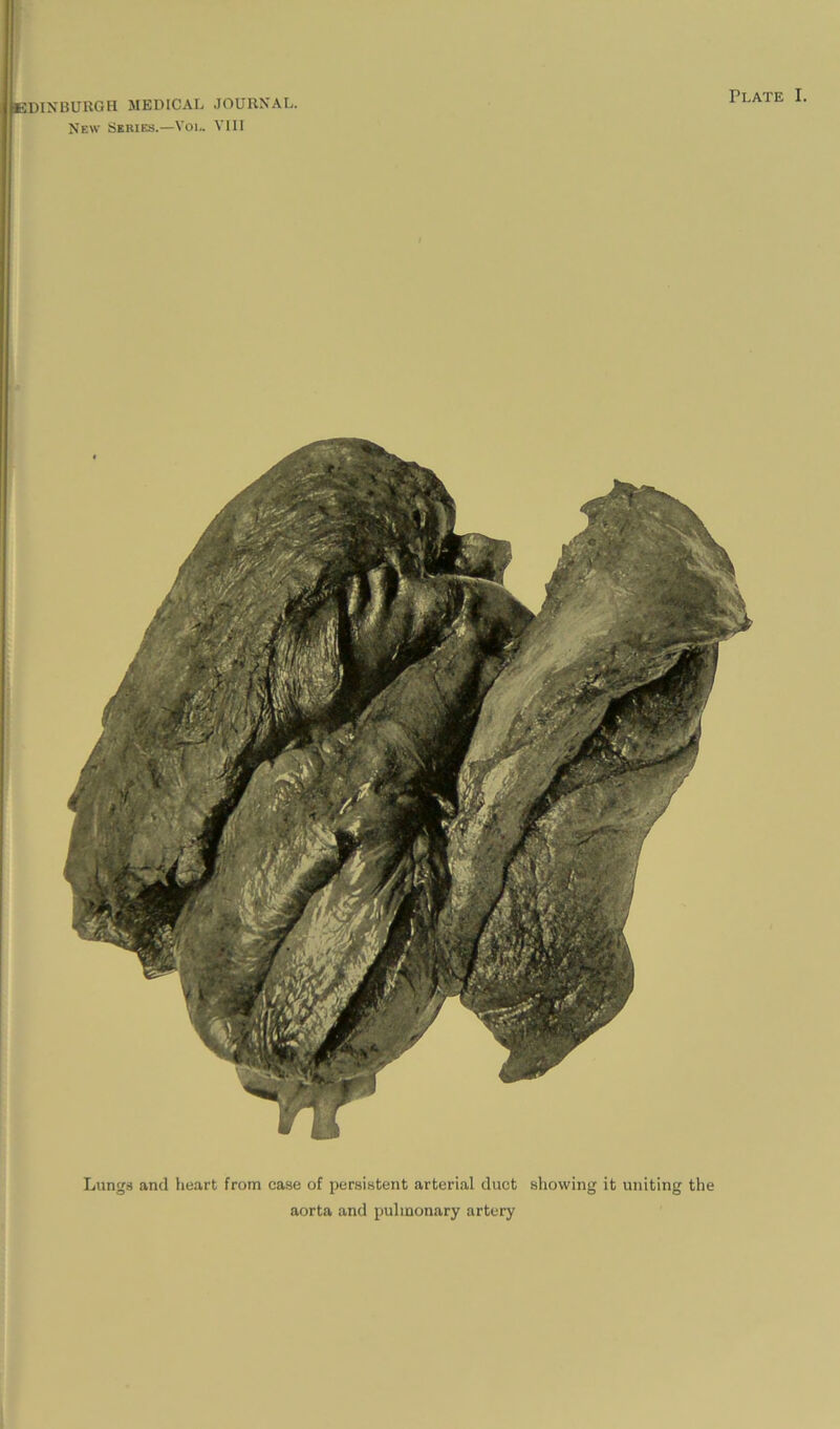 Plate I. Lungs and heart from case of persistent arterial duct showing it uniting the aorta and pulmonary artery ([EDINBURGH MEDICAL JOURNAL.