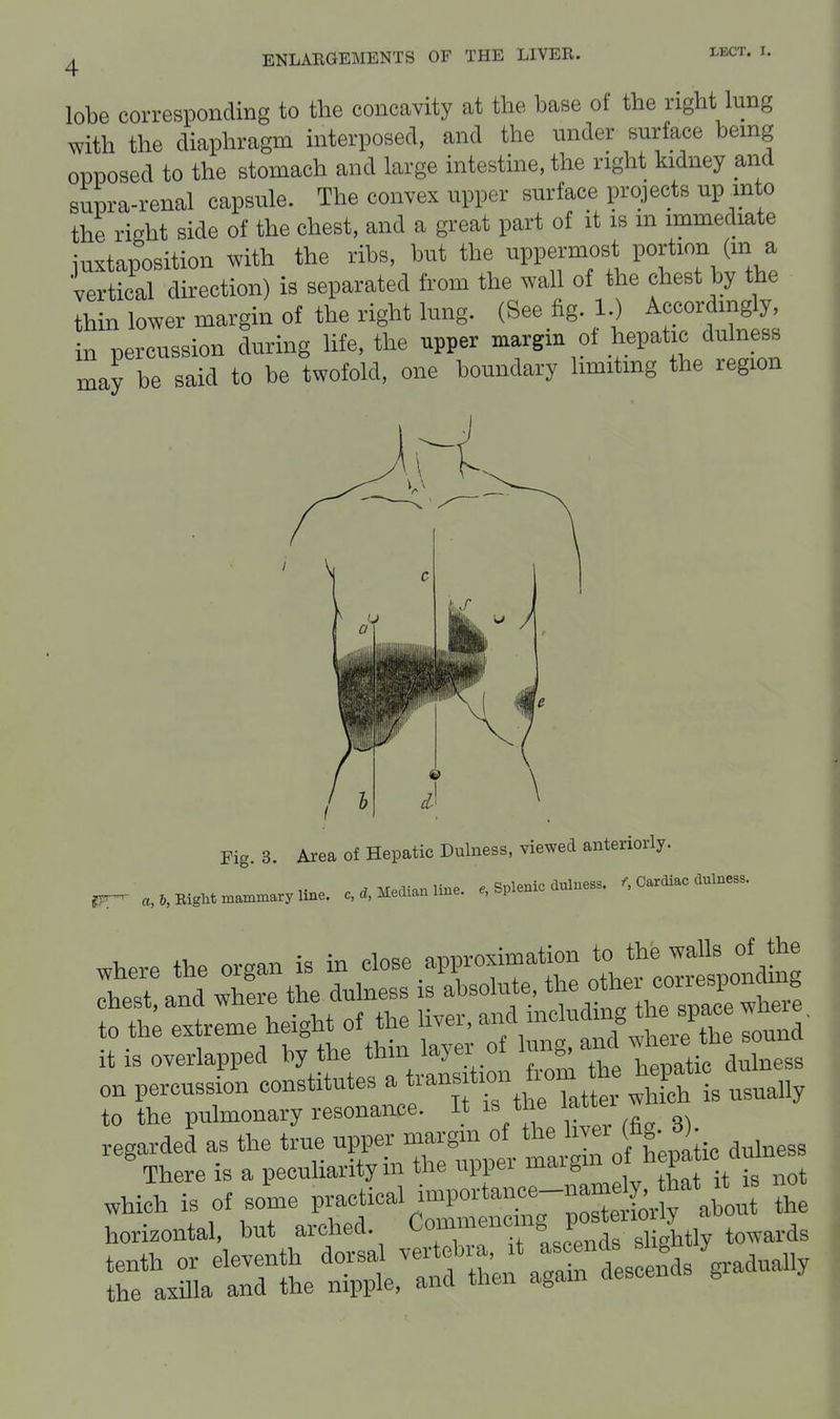 lobe corresponding to the conccavity at the base of the right lung with the diaphragm interposed, and the under surface being opposed to the stomach and large intestine, the right kidney and supra-renal capsule. The convex upper surface projects up into the right side of the chest, and a great part of it is m immediate juxtaposition with the ribs, but the uppermost portion (m a vertical direction) is separated from the wall of the chest by the thin lower margin of the right lung. (See fig. 1.) Accordingly, in percussion during life, the upper margin of hepatic dulness may be said to be twofold, one boundary hmitmg the region Fig. 3. Area of Hepatic Dulness, viewed anteriorly. Bight n.an..ary line. c. Medianline. . Splenic dulness. , Cardiac dulness. on percussfon constitutes ^^/^f-^^^'f.tt^S^ to the pulmonary resonance. It is the Jaiiei regarded as the true upper margm of the 1^^ J«; 'j; There is a peculiarity in the upper margm ^^^P^^^^^^^^ .hich is of some Poetical inn-tan.e namdy^^^^^^^^^ - horizontal, but arched Commen mg posteuo |^ ^^^^^ tenth or eleventh do-a^^-rteU t as ends s g^^ the axilla and the nipple, and taen a^am