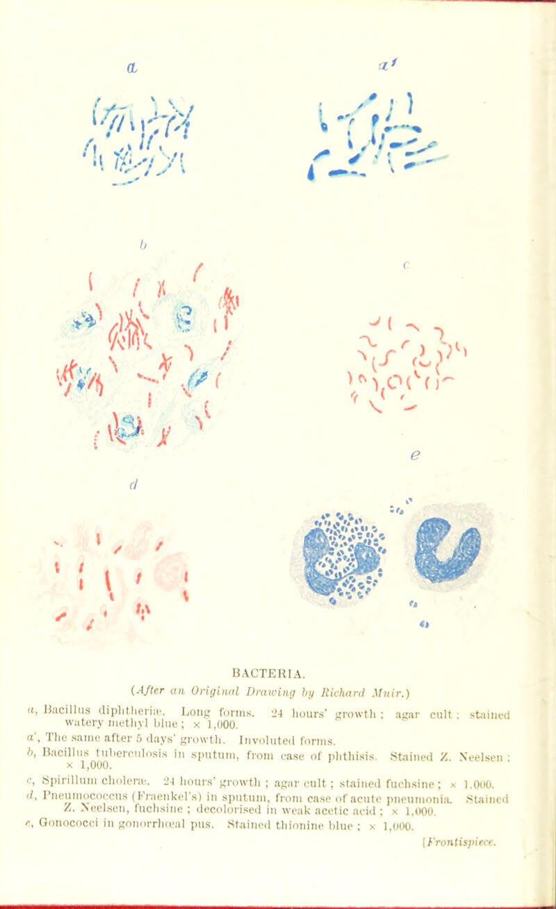 BACTERIA. {After an Original Drawing by Richard Muir.) a, Bacillus diphtherias. Long forms. 24 hours' growth: agar cult; stained watery methj 1 blue ; x l.ooo. '• Tne sa' after 5 'lays- growth. Involuted forms. 6, Bacillus tuberculosis In sputum, from rase of phthisis. Stained 7.. Neelsen : <; Spirillum cholera-, lm hours' growth ; agar cult; stained fuchsine; x 1.000. d, Pneuinococcus (Kraenkel's) in sputum, from case of acute pneumonia. Stained /. Neelsen, fuchsine ; decolorised in weak acetic acid ; x 1.000. e, Gonococci in gonorrhceal pus. Stained thionine blue ; • 1,000 [Frontispiece.