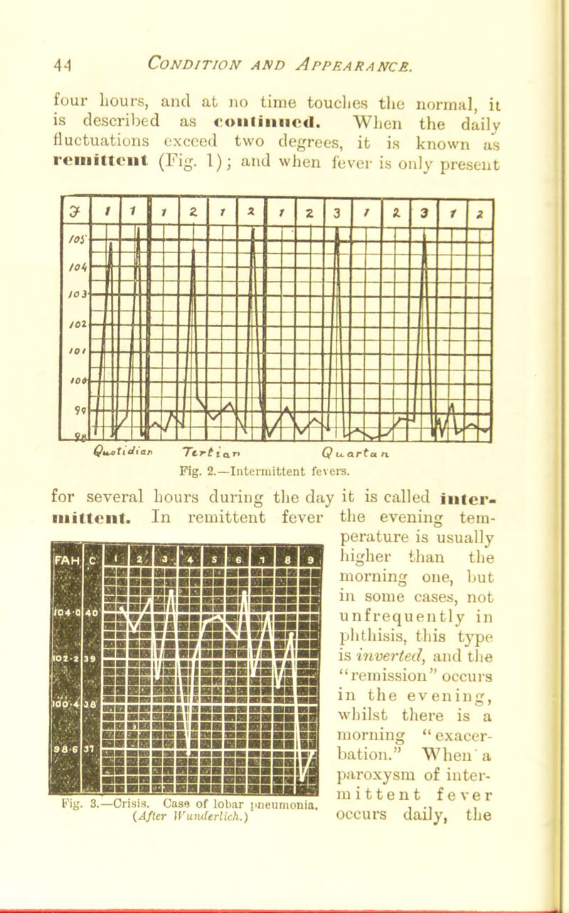 four hours, and at no time touches the normal, it is described as continued. When the daily fluctuations exceed two degrees, it is known as remittent (Fig. 1); and when fever is only present Fig. 2.—Intermittent fevers. for several hours during the day it is called inter- mittent. In remittent fever the evening tem- perature is usually higher than the morning one, but in some cases, not unfrequently in phthisis, this type is inverted, and the remission occurs in the evening, whilst there is a morning  exacer- bation. When'a paroxysm of inter- mittent fever occurs daily, the mmmwmm KBumuanaiBiL. PBftBHFHHS itkWJlMia MF:<aii »i in HKBiiuiit iNi <nni BM »«H» Mil |iaaa» .»mmimmmn rinvjiw ssss:.s::issssijsisr | ■■■iiyn i an mi mmmmx m i ~iii;niiDiamMi IIIBI Bill! mi S3 £31 mnnni iuiihi ■■■■■■I inBBBHin on ■■aaHBIMBIHIIlll ■■■■■■■■mil iSSSSESSBSS' iMMMBBMaMH .—Crisis. Case of lobar pneumonia. (After Wunderlich.)