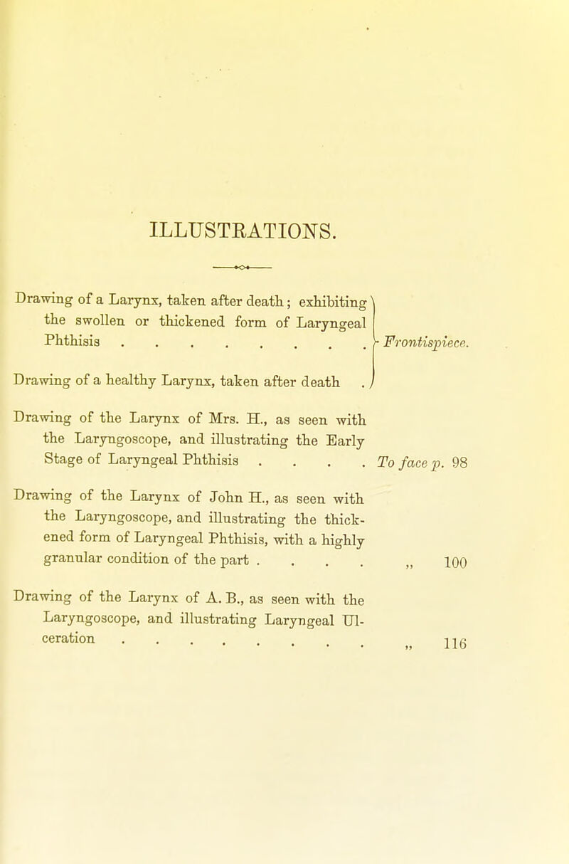 ILLUSTEATIONS. Drawing of a Larynx, taken after death; exMbiting' the swollen or thickened form of Laryngeal Phthisis y Frontispiece. Drawing of a healthy Larynx, taken after death . > Drawing of the Larynx of Mrs. H., as seen with the Laryngoscope, and illustrating the Early Stage of Laryngeal Phthisis . . , .To face p. 98 Drawing of the Larynx of John H., as seen with the Laryngoscope, and illustrating the thick- ened form of Laryngeal Phthisis, with a highly granular condition of the part . . . . „ 100 Drawing of the Larynx of A. B., as seen with the Laryngoscope, and illustrating Laryngeal Ul- ceration 116