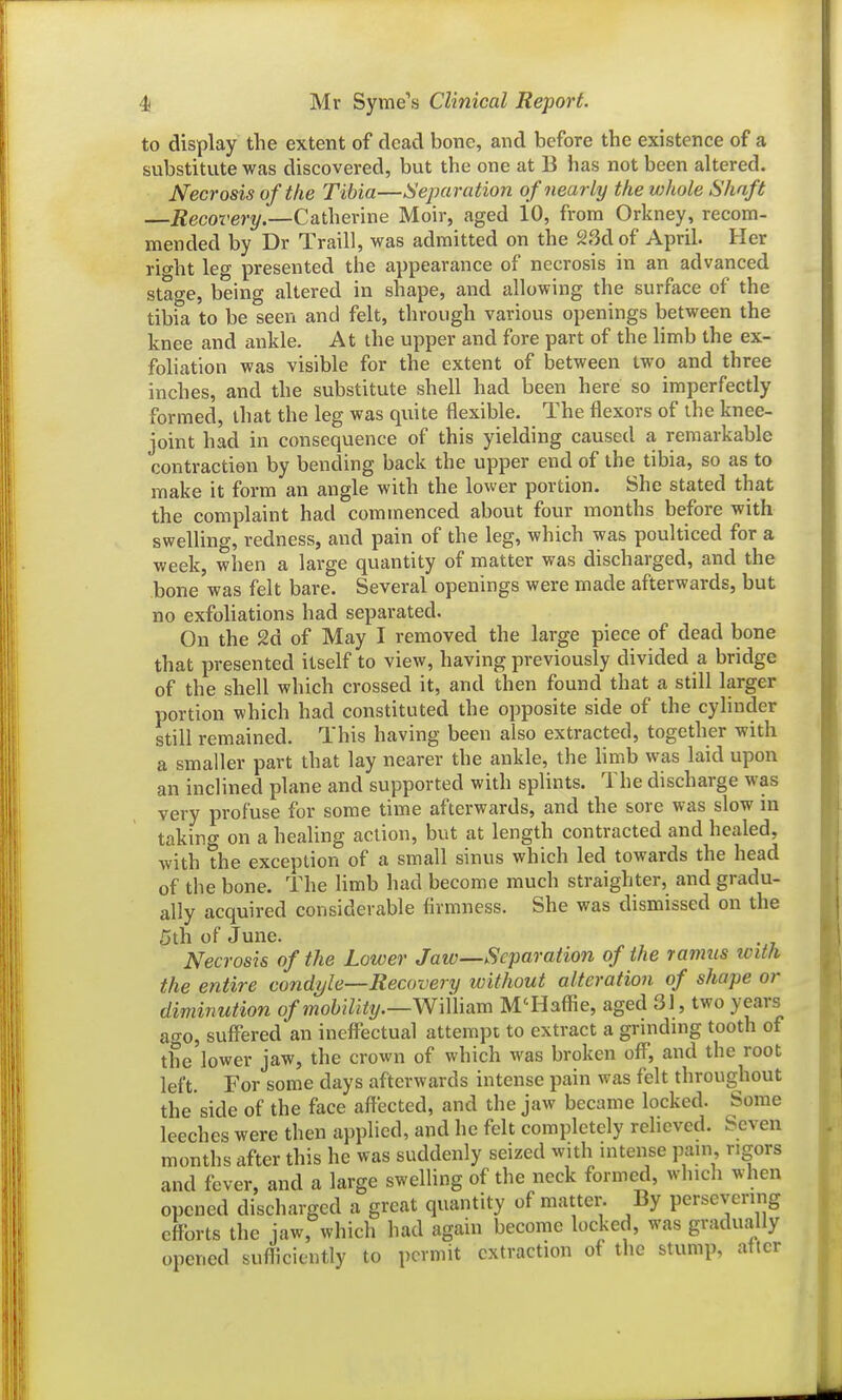 to display the extent of dead bone, and before the existence of a substitute was discovered, but the one at B has not been altered. Necrosis of the Tibia—Separation of nearly the whole Shaft —Recovery.—Catherine Moir, aged 10, from Orkney, recom- mended by Dr Traill, was admitted on the 23d of April. Her rio-ht leg presented the appearance of necrosis in an advanced stage, being altered in shape, and allowing the surface of the tibia to be seen and felt, through various openings between the knee and ankle. At the upper and fore part of the limb the ex- foliation was visible for the extent of between two and three inches, and the substitute shell had been here so imperfectly formed, that the leg was quite flexible. The flexors of the knee- joint had in consequence of this yielding caused a remarkable contraction by bending back the upper end of the tibia, so as to make it form an angle with the lower portion. She stated that the complaint had commenced about four months before with swelling, redness, and pain of the leg, which was poulticed for a week, when a large quantity of matter was discharged, and the bone was felt bare. Several openings were made afterwards, but no exfoliations had separated. On the 2d of May I removed the large piece of dead bone that presented itself to view, having previously divided a bridge of the shell which crossed it, and then found that a still larger portion which had constituted the opposite side of the cylinder still remained. This having been also extracted, together with a siTialler part that lay nearer the ankle, the limb was laid upon an inclined plane and supported with splints. The discharge was very profuse for some time afterwards, and the sore was slow in taking on a healing action, but at length contracted and healed, with the exception of a small sinus which led towards the head of the bone. The limb had become much straighter, and gradu- ally acquired considerable firmness. She was dismissed on the 5th of June. Necrosis of the Lower Jaw—Separation of the ramus wit/i the entire condyle—Recovery without alteration of shape or diminution of mobility.—W\\\hm M'Haffie, aged 3J, two years a^o, sufferedan ineffectual attempt to extract a grinding tooth of the lower jaw, the crown of which was broken off, and the root left. For some days afterwards intense pain was felt throughout the side of the face affected, and the jaw became locked. Some leeches were then applied, and he felt completely relieved. Seven months after this he was suddenly seized with nitense pam rigors and fever, and a large swelling of the neck formed, which when opened discharged a great quantity of matter. By persevering efforts the jaw, which had again become locked, was gradually opened sufhciently to permit extraction of the stump, after