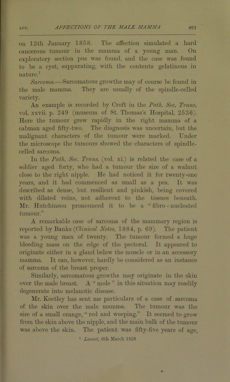on 13tli January 1858. The affection simulated a hard cancerous tumour in the mamma of a young man. On exploratory section pus was found, and the case was found to be a cyst, suppurating, with the contents gelatinous in nature.1 Sarcoma.—Sarcomatous growths may of course be found in the male mamma. They are usually of the spindle-celled variety. An example is recorded by Croft in the Path. Soc. Trans. vol. xxvii. p. 249 (museum of St. Thomas’s Hospital, 2536). Here the tumour grew rapidly in the right mamma of a cabman aged fifty-two. The diagnosis was uncertain, but the malignant characters of the tumour were marked. Under the microscope the tumours showed the characters of spindle- celled sarcoma. In the Path. Soc. Trans, (vol. xi.) is related the case of a soldier aged forty, who had a tumour the size of a walnut close to the right nipple. He had noticed it for twenty-one years, and it had commenced as small as a pea. It was described as dense, but resilient and pinkish, being covered with dilated veins, not adherent to the tissues beneath. Mr. Hutchinson pronounced it to be a “ fibro - nucleated tumour.” A remarkable case of sarcoma of the mammary region is reported by Banks {Clinical Notes, 1884, p. 69). The patient was a young man of twenty. The tumour formed a huge bleeding mass on the edge of the pectoral. It appeared to originate either in a gland below the muscle or in an accessory mamma. It can, however, hardly be considered as an instance of sarcoma of the breast proper. Similarly, sarcomatous growths may originate in the skin over the male breast. A “ mole ” in this situation may readily degenerate into melanotic disease. Mr. Keetley has sent me particulars of a case of sai'coma of the skin over the male mamma. The tumour was the size of a small orange, “ red and weeping.” It seemed to grow from the skin above the nipple, and the main bulk of the tumour was above the skin. The patient was fifty-five years of age, 1 Lancet, 6th March 1858