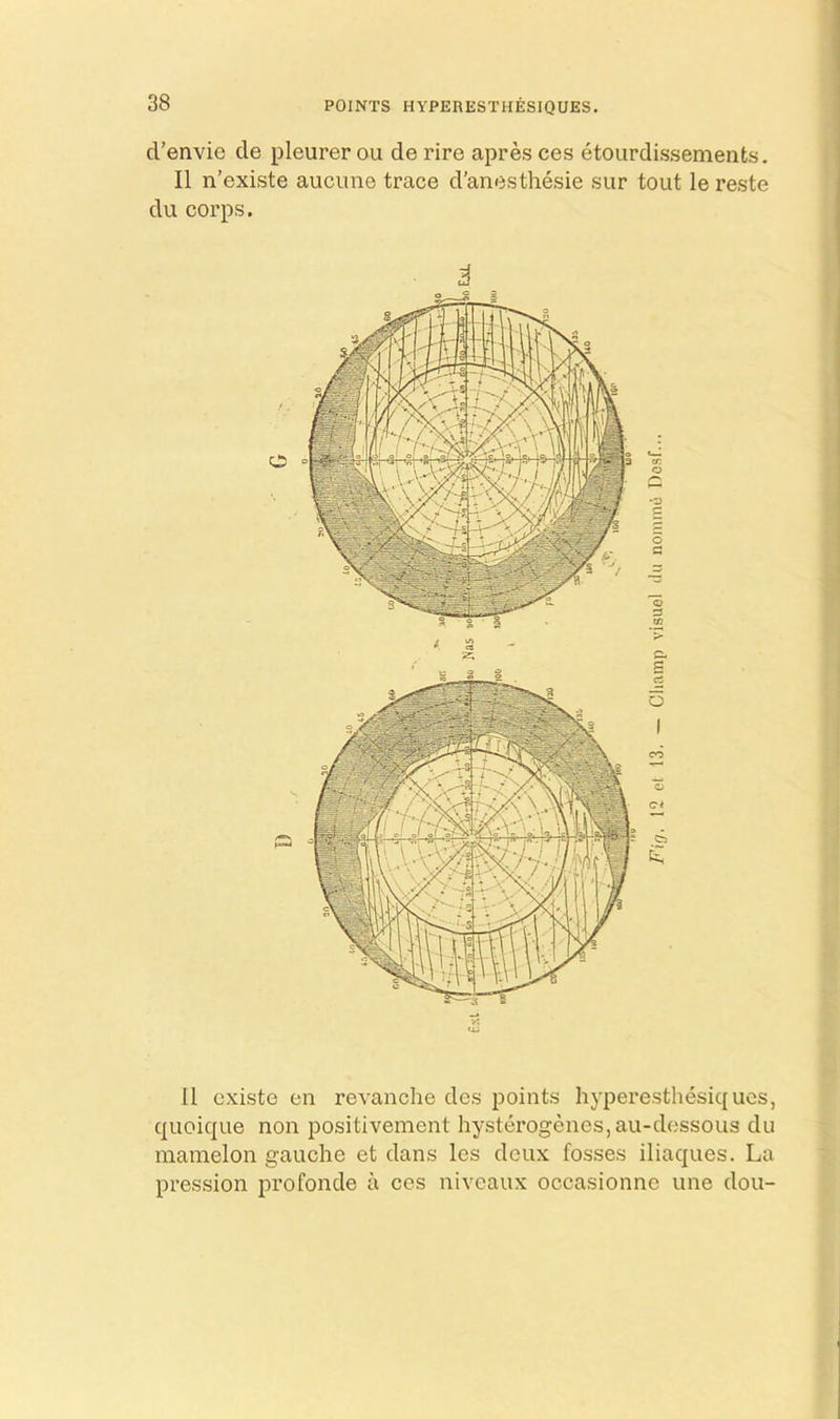 POINTS HYPERESTHESIQUES cl’envio cle pleurer ou de rire apres ces etourdissements. II n’existe aucune trace d’anesthesie sur tout le reste du corps. o o a g rt O CD 11 cxiste en revanche des points hyperesthesiqucs, quoique non positivement hysterogencs,au-dessous du mamelon gauche et dans les deux fosses iliaques. La pression profonde a ces niveaux occasionne une dou-