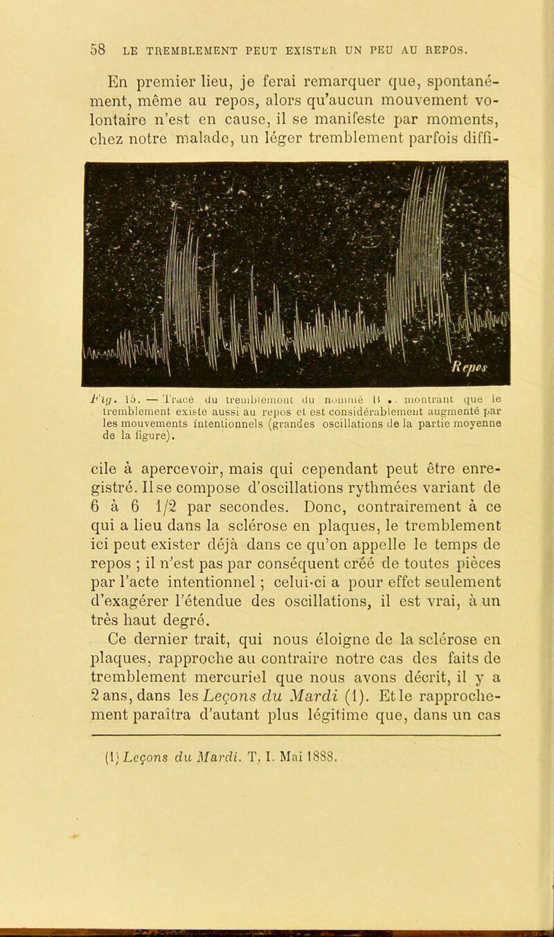 En premier lieu, je ferai remarquer que, spontane- ment, meme au repo.s, alors qu’aucun mouvement vo- lontaire n’est en cause, il se manifeste par moments, chez notre malade, un leger tremblement parfois diffi- b'lg. 15. —Trace du tremblemoal du noiimie li montrant que le tremblement existe aussi au repos et est considerablemeiit augmente par les mouvements intentionnels (grandes oscillations ile la partie moyenne de la figure). cile a apercevoir, mais qui cependant pent etre enre- gistre. Use compose d’oscillations rythmees variant de 6 a 6 1/2 par secondes. Done, contrairement a ce qui a lieu dans la sclerose en plaques, le tremblement ici pent exister deja dans ce qu’on appelle le temps de repos ; il n’est pas par consequent cree de toutes pieces par I’acte intentionnel; celui-ci a pour effet seulement d’exagerer I’etendue des oscillations, il est vrai, a un tres baut degre. Ce dernier trait, qui nous eloigne de la sclerose en IDlaques, rapproebe au contraire notre cas des faits de tremblement mercuriel que nous avons decrit, il y a 2ans,dans les Lemons du Mardi (1). Etle rapproche- ment paraitra d’autant plus legitime que, dans un cas (1; Logons du Mardi. T. I. Mai 1888.