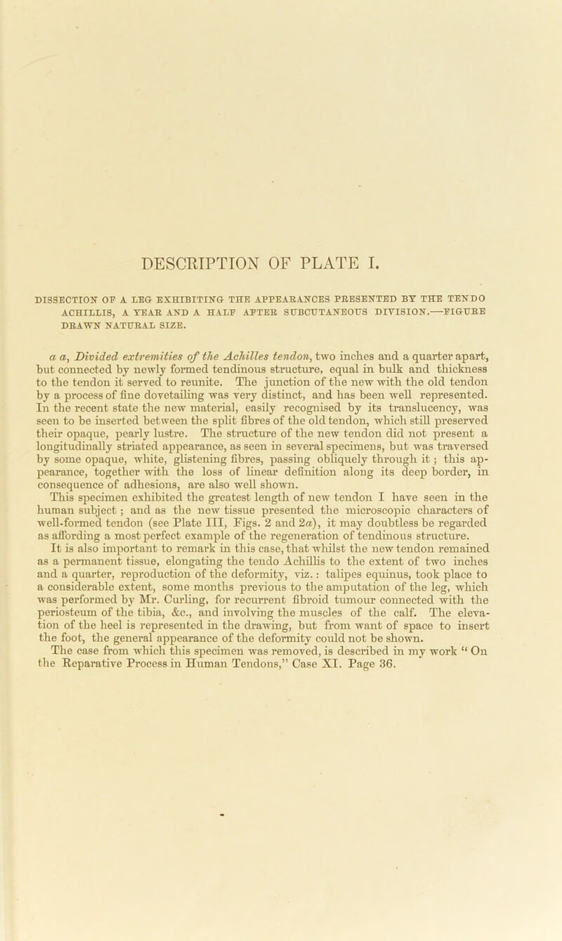 DISSECTION OF A LEG EXHIBITING THE APPEARANCES PRESENTED BY THE TENDO ACHILLIS, A YEAR AND A HALF AFTER SUBCUTANEOUS DIVISION. FIGURE DRAWN NATURAL SIZE. a a, Divided extremities of the Achilles tendon, two inches and a quarter apart, but connected by newly formed tendinous structure, equal in bulk and thickness to the tendon it served to reunite. The junction of the new with the old tendon by a process of fine dovetailing was very distinct, and has been well represented. In the recent state the new material, easily recognised by its translucency, was seen to be inserted between the split fibres of the old tendon, which still preserved them opaque, pearly lustre. The structure of the new tendon did not present a longitudinally striated appearance, as seen in several specimens, but was traversed by some opaque, white, glistening fibres, passing obliquely through it; this ap- pearance, together with the loss of linear definition along its deep border, in consequence of adhesions, are also well shown. This specimen exhibited the greatest length of new tendon I have seen in the human subject; and as the new tissue presented the microscopic characters of well-formed tendon (see Plate III, Figs. 2 and 2a), it may doubtless be regarded as affording a most perfect example of the regeneration of tendinous structure. It is also important to remark in this case, that whilst the new tendon remained as a permanent tissue, elongating the tendo Achillis to the extent of two inches and a quarter, reproduction of the deformity, viz.: talipes equinus, took place to a considerable extent, some months previous to the amputation of the leg, which was performed by Mr. Curling, for recurrent fibroid tumour connected with the periosteum of the tibia, &c., and involving the muscles of the calf. The eleva- tion of the heel is represented in the drawing, but from want of space to insert the foot, the general appearance of the deformity could not be shown. The case from which this specimen was removed, is described in my work “ On the Reparative Process in Human Tendons,” Case XI. Page 36.