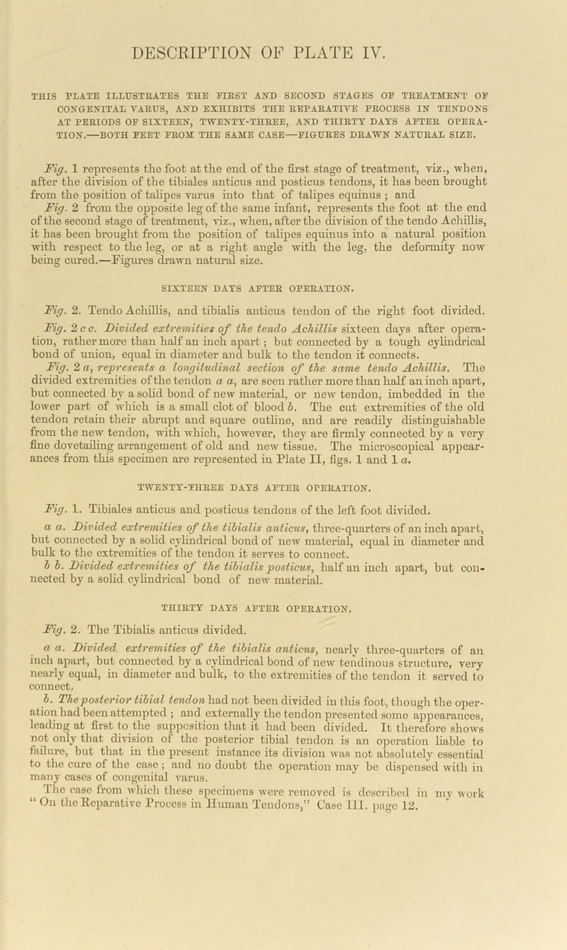 THIS PLATE ILLUSTRATES THE FIEST AND SECOND STAGES OF TEEATMENT OF CONGENITAL YAET7S, AND EXHIBITS THE REPARATIVE PEOCESS IN TENDONS AT PEEIODS OF SIXTEEN, TWENTY-THREE, AND THIRTY DAYS AFTEE OPEIIA- TION. BOTH FEET FROM THE SAME CASE—FIGUBES DRAWN NATUEAL SIZE. Fig. 1 represents the foot at the end of the first stage of treatment, viz., when, after the division of the tibiales anticus and posticus tendons, it has been brought from the position of talipes varus into that of talipes equinus ; and Fig. 2 from the opposite leg of the same infant, represents the foot at the end of the second stage of treatment, viz., when, after the division of the tendo Achillis, it has been brought from the position of talipes equinus into a natural position with respect to the leg, or at a right angle with the leg, the deformity now being cured.—Figures drawn natural size. SIXTEEN DAYS AFTEE OPEEATION. Fig. 2. Tendo Acliillis, and tibialis anticus tendon of the right foot divided. Fig. 2 cc. Divided extremities of the tendo Achillis sixteen days after opera- tion, rather more than half an inch apart; hut connected by a tough cylindrical bond of union, equal in diameter and bulk to the tendon it connects. Fig. 2 a, represents a longitudinal section of the same tendo Achillis. The divided extremities of the tendon a a, are seen rather more than half an inch apart, hut connected by a solid bond of new material, or new tendon, imbedded in the lower part of which is a small clot of blood b. The cut extremities of the old tendon retain their abrupt and square outline, and are readily distinguishable from the new tendon, with which, however, they are firmly connected by a very fine dovetailing arrangement of old and new tissue. The microscopical appear- ances from this specimen are represented in Plate II, figs. 1 and 1 a. TWENTY-THEEE DAYS AFTEE OPEEATION. Fig. 1. Tibiales anticus and posticus tendons of the left foot divided. a a. Divided extremities of the tibialis anticus, three-quarters of an inch apart, but connected by a solid cylindrical bond of new material, equal in diameter and bulk to the extremities of the tendon it serves to connect. b b. Divided extremities of the tibialis posticus, half an inch apart, but con- nected by a solid cylindrical bond of new material. THIETY DAYS AFTEE OPEEATION. Fig. 2. The Tibialis anticus divided. a a. Divided extremities of the tibialis anticus, nearly three-quarters of an inch apart, but connected by a cylindrical bond of new tendinous structure, very nearly equal, in diameter and bulk, to the extremities of the tendon it served to connect. b. The posterior tibial tendon had not been divided in this foot, though the oper- ation had been attempted ; and externally the tendon presented some appearances, leading at first to the supposition that it had been divided. It therefore shows not only that division of the posterior tibial tendon is an operation liable to failure, but that in the present instance its division was not absolutelv essential to the cure of the case ; and no doubt the operation may be dispensed with in many cases of congenital varus. The case from which these specimens were removed is described in my work “On theReparativo Process in Human Tendons,” Case III. page 12.