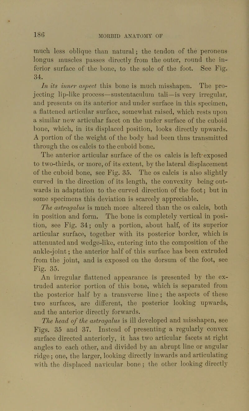 much less oblique than natural; the tendon of the peroneus longus muscles passes directly from the outer, round the in- ferior surface of the bone, to the sole of the foot. See Fig. 34. In its inner aspect this bone is much misshapen. The pro- jecting lip-like process—sustentaculum tali—is very irregular, and presents on its anterior and under surface in this specimen, a flattened articular surface, somewhat raised, which rests upon a similar new articular facet on the under surface of the cuboid bone, which, in its displaced position, looks directly upwards. A portion of the weight of the body had been thus transmitted through the os calcis to the cuboid bone. The anterior articular surface of the os calcis is left'exposed to two-thirds, or more, of its extent, by the lateral displacement of the cuboid bone, see Fig. 35. The os calcis is also slightly curved in the direction of its length, the convexity being out- wards in adaptation to the curved direction of the foot; but in some specimens this deviation is scarcely appreciable. The astragalus is much more altered than the os calcis, both in position and form. The bone is completely vertical in posi- tion, see Fig. 34; only a portion, about half, of its superior articular surface, together with its posterior border, which is attenuated and wedge-like, entering into the composition of the ankle-joint; the anterior half of this surface has been extruded from the joint, and is exposed on the dorsum of the foot, see Fig. 35. An irregular flattened appearance is presented by the ex- truded anterior portion of this bone, which is separated from the posterior half by a transverse line; the aspects of these two surfaces, are different, the posterior looking upwards, and the anterior directly forwards. The head of the astragalus is ill developed and misshapen, see Figs. 35 and 37. Instead of presenting a regularly convex surface directed anteriorly, it has two articular facets at right angles to each other, and divided by an abrupt line or angular ridge; one, the larger, looking directly inwards and articulating with the displaced navicular bone; the other looking directly