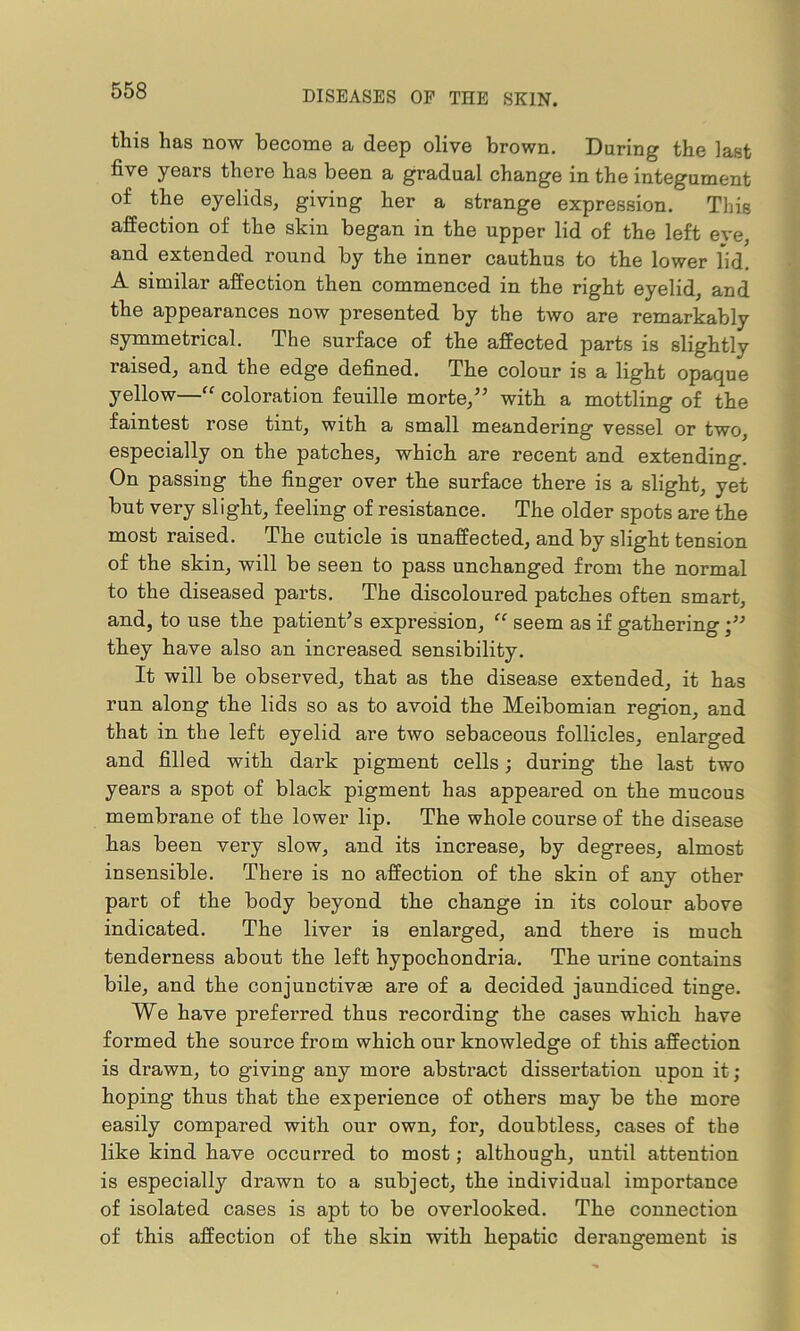 this has now become a deep olive brown. Daring the last five years there has been a gradual change in the integument of the eyelids, giving her a strange expression. This affection of the skin began in the upper lid of the left eye, and extended round by the inner cauthus to the lower lid. A similar affection then commenced in the right eyelid, and the appearances now presented by the two are remarkably symmetrical. The surface of the affected parts is slightly raised, and the edge defined. The colour is a light opaque yellow—“ coloration feuille morte,” with a mottling of the faintest rose tint, with a small meandering vessel or two, especially on the patches, which are recent and extending. On passing the finger over the surface there is a slight, yet but very slight, feeling of resistance. The older spots are the most raised. The cuticle is unaffected, and by slight tension of the skin, will be seen to pass unchanged from the normal to the diseased parts. The discoloured patches often smart, and, to use the patient’s expression, “ seem as if gathering they have also an increased sensibility. It will be observed, that as the disease extended, it has run along the lids so as to avoid the Meibomian region, and that in the left eyelid are two sebaceous follicles, enlarged and filled with dark pigment cells; during the last two years a spot of black pigment has appeared on the mucous membrane of the lower lip. The whole course of the disease has been very slow, and its increase, by degrees, almost insensible. There is no affection of the skin of any other part of the body beyond the change in its colour above indicated. The liver is enlarged, and there is much tenderness about the left hypochondria. The urine contains bile, and the conjunctivas are of a decided jaundiced tinge. We have preferred thus recording the cases which have formed the source from which our knowledge of this affection is drawn, to giving any more abstract dissertation upon it; hoping thus that the experience of others may be the more easily compared with our own, for, doubtless, cases of the like kind have occurred to most; although, until attention is especially drawn to a subject, the individual importance of isolated cases is apt to be overlooked. The connection of this affection of the skin with hepatic derangement is